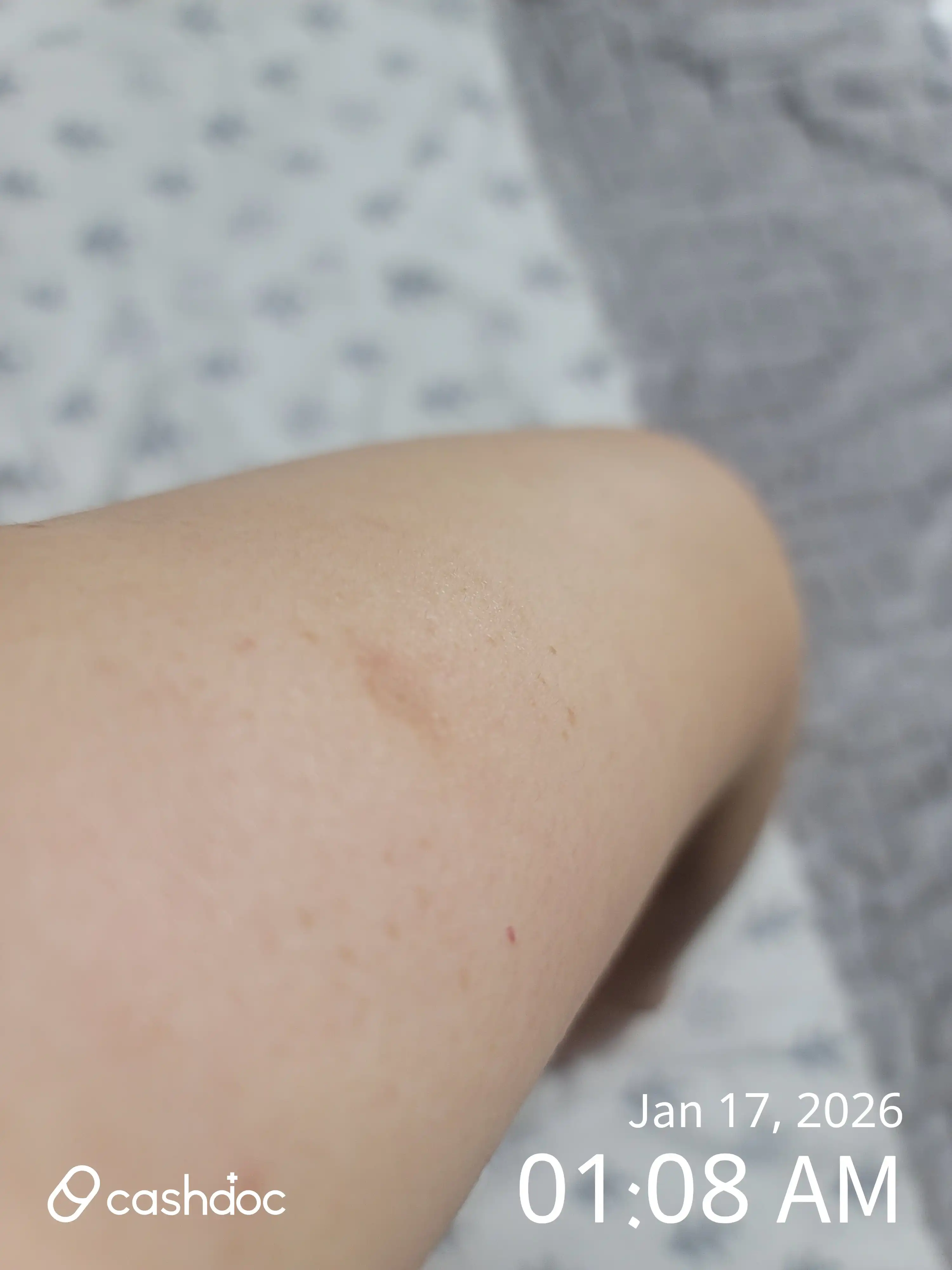 Review photo