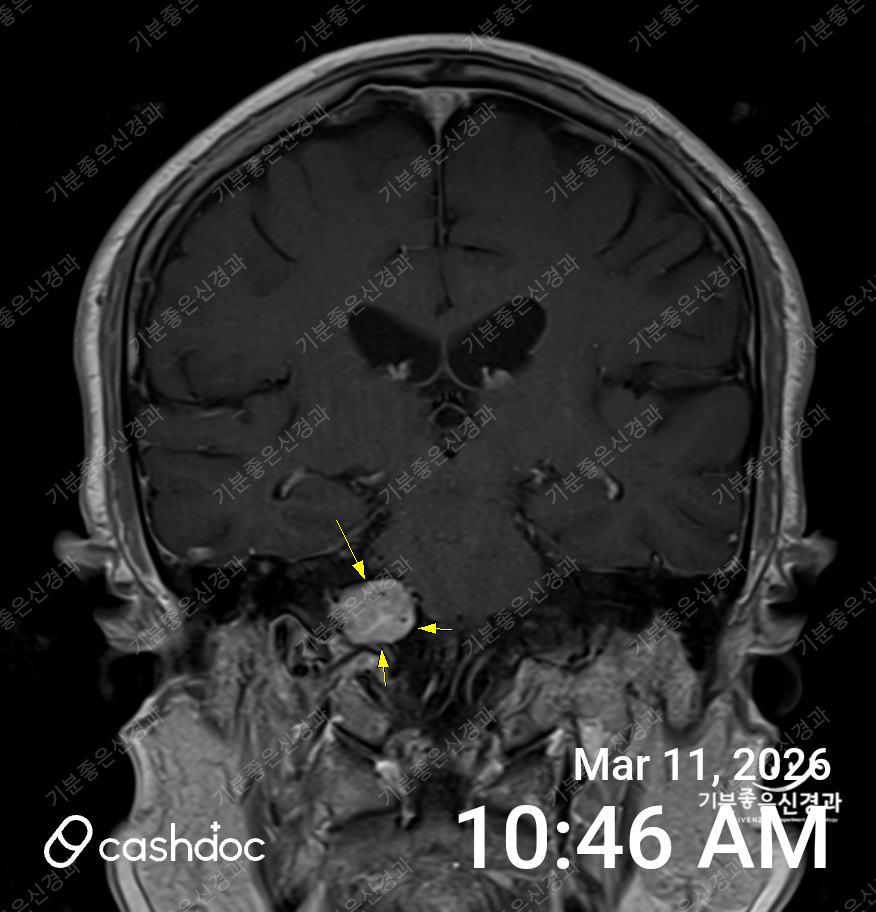 남동구 기분좋은신경과의원, 두통 진단 과정 만족했어요