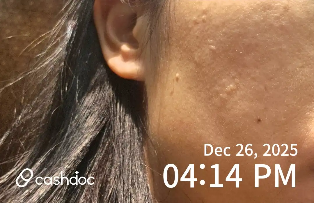 Review photo