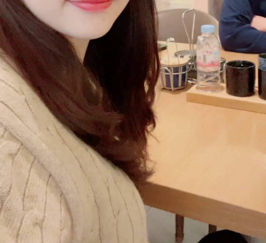 시술 후 — 튀어나온 턱라인 정리. 침샘보톡스