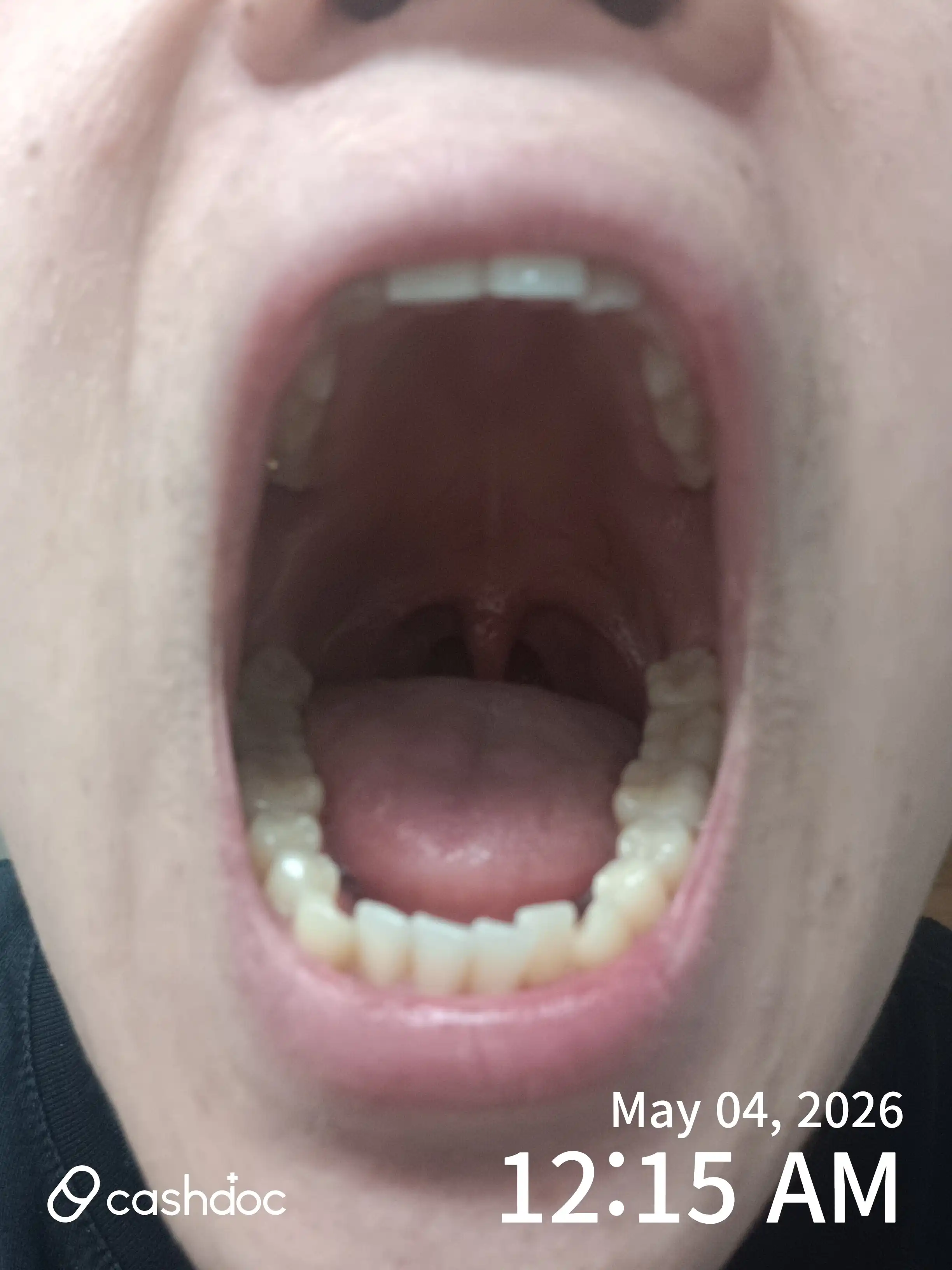 Review photo