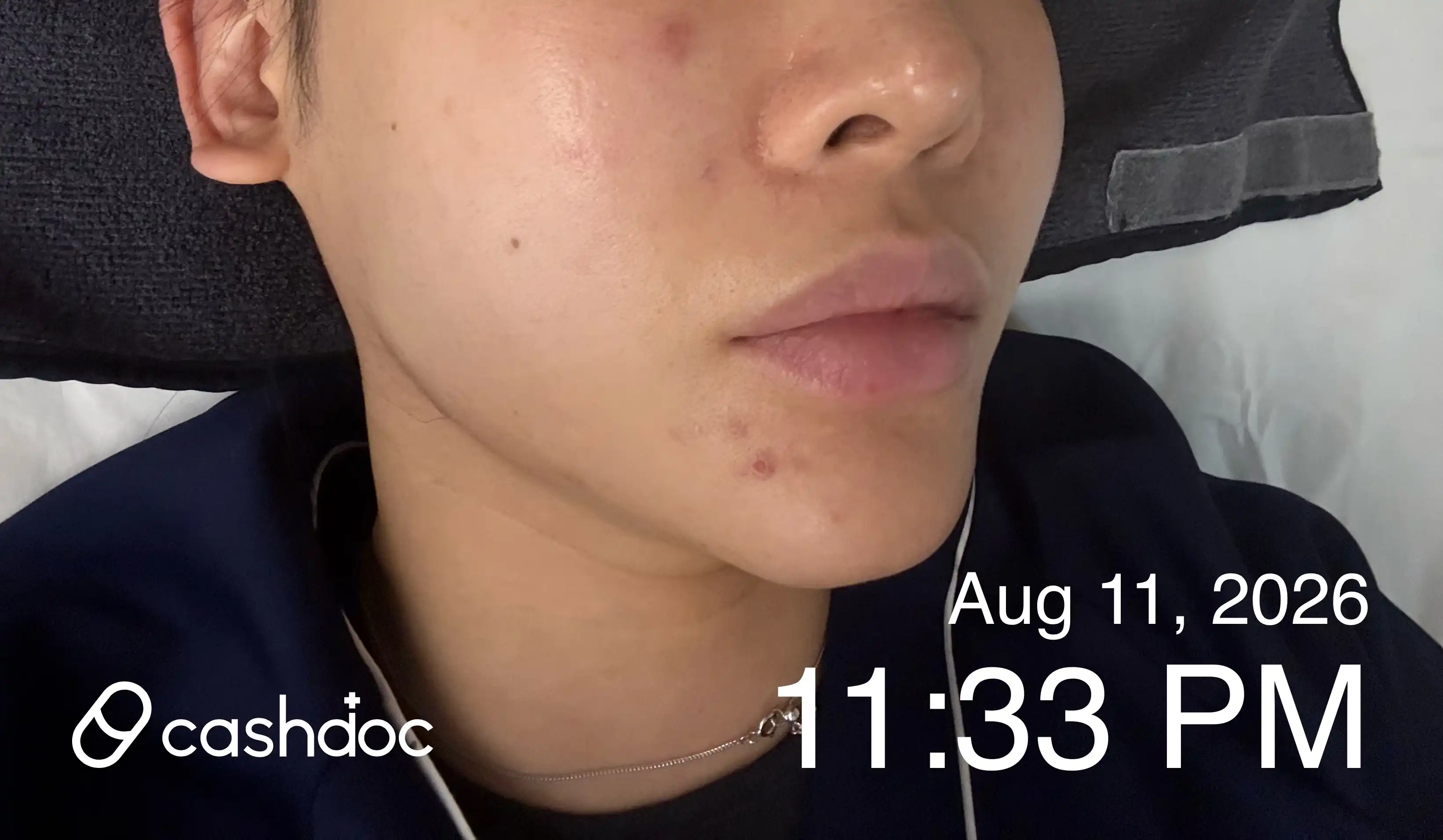 评价照片
