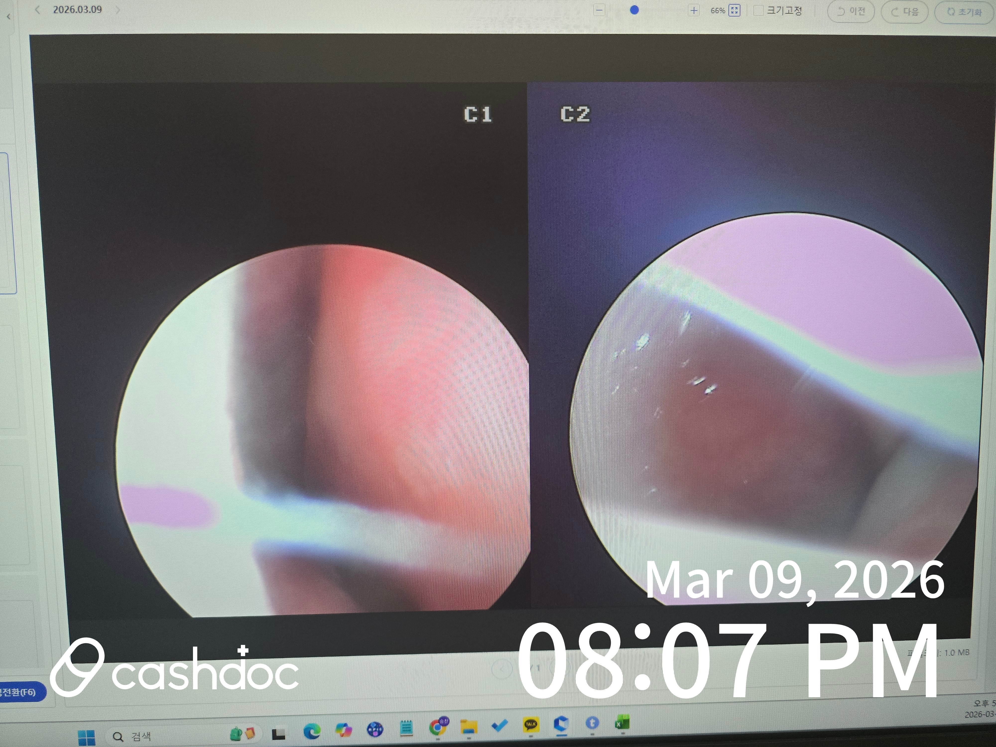 부평구 뱅뱅이비인후과에서 받은 비염 치료 후기