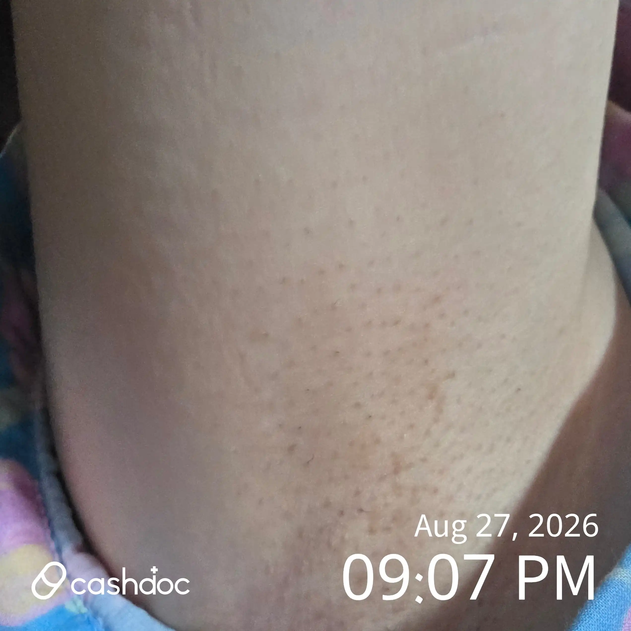 Review photo
