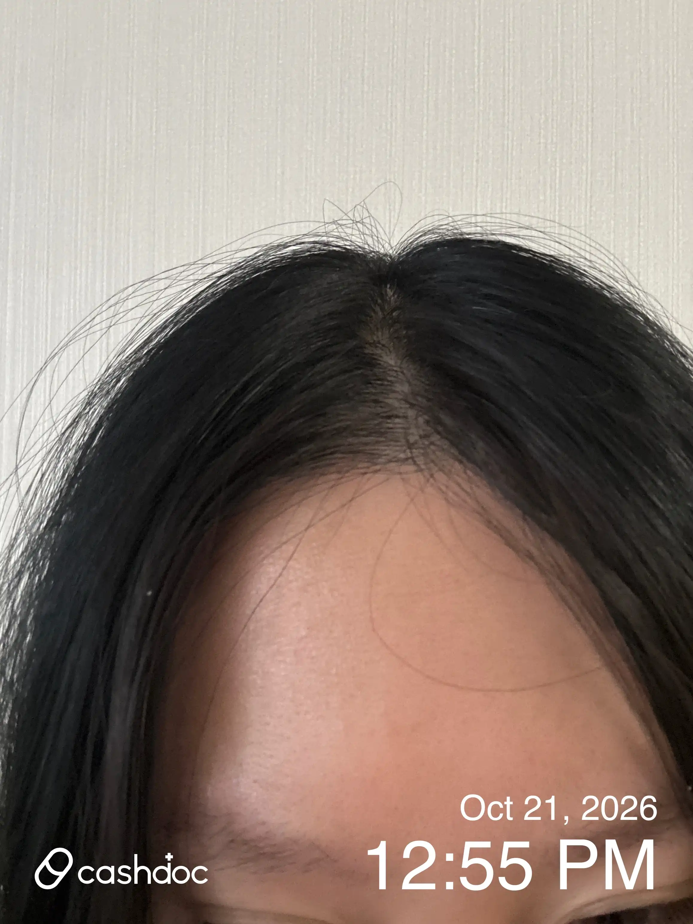 美璞诊所 花井分院 评价照片