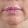 後