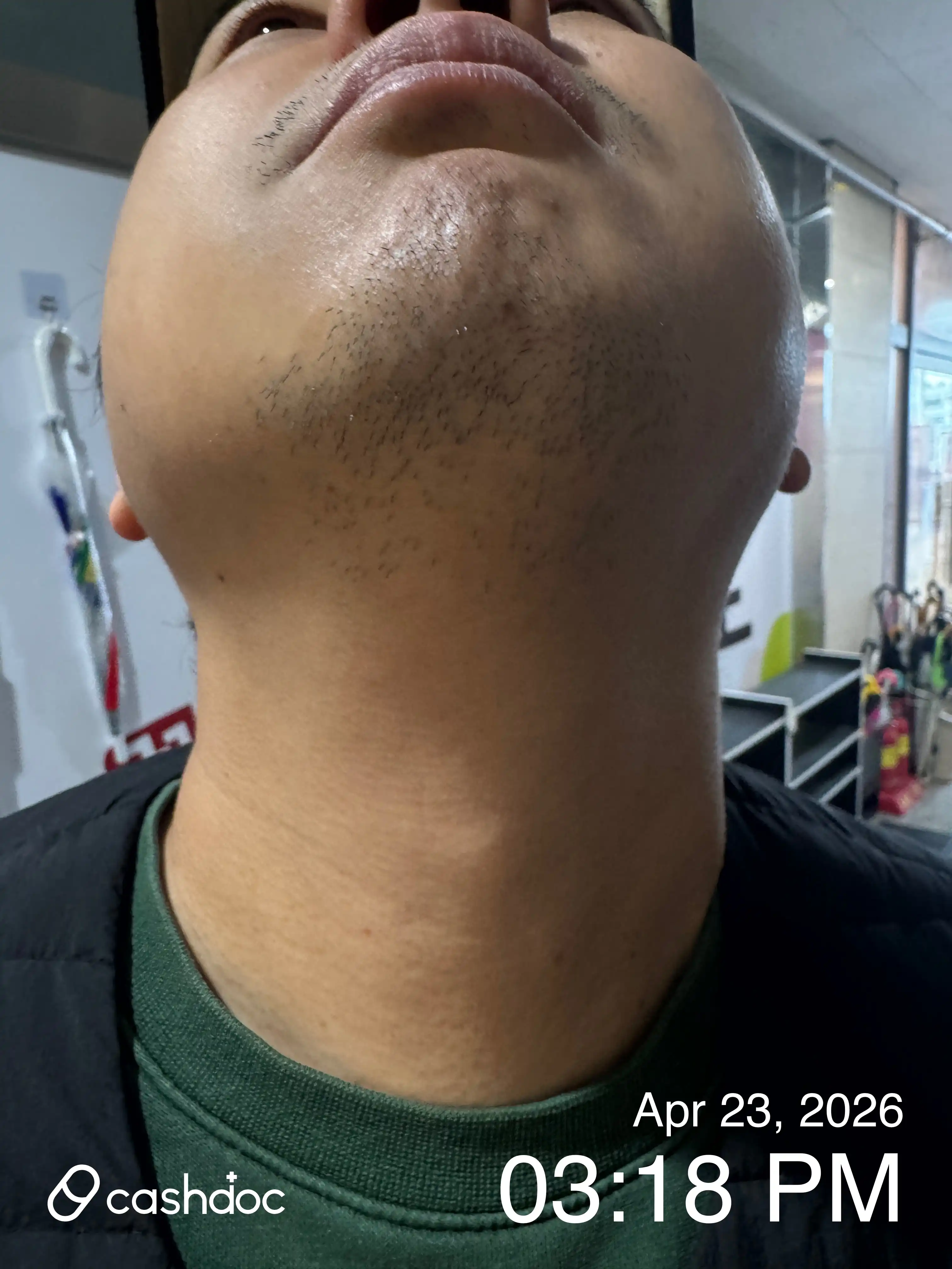 Review photo