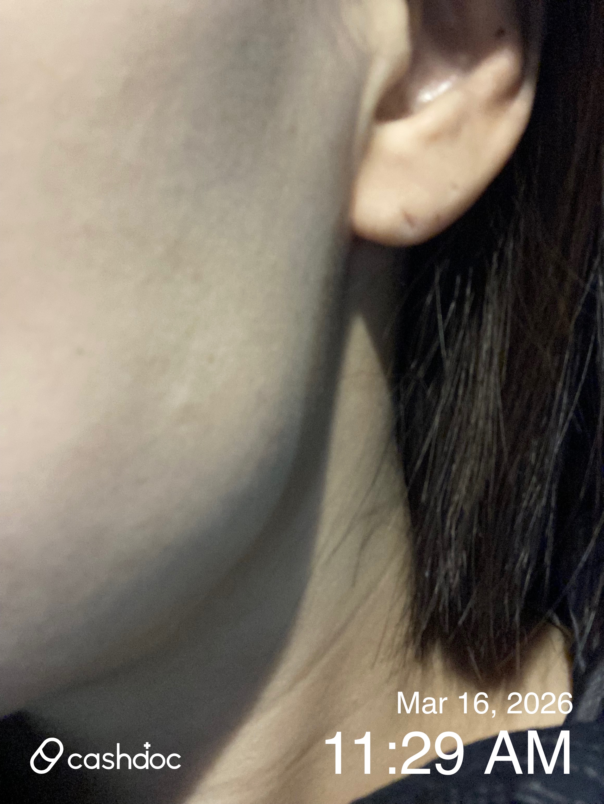 남양주시 메이퓨어의원 평내호평점, 턱 보톡스 대기 시간 거의 없어요