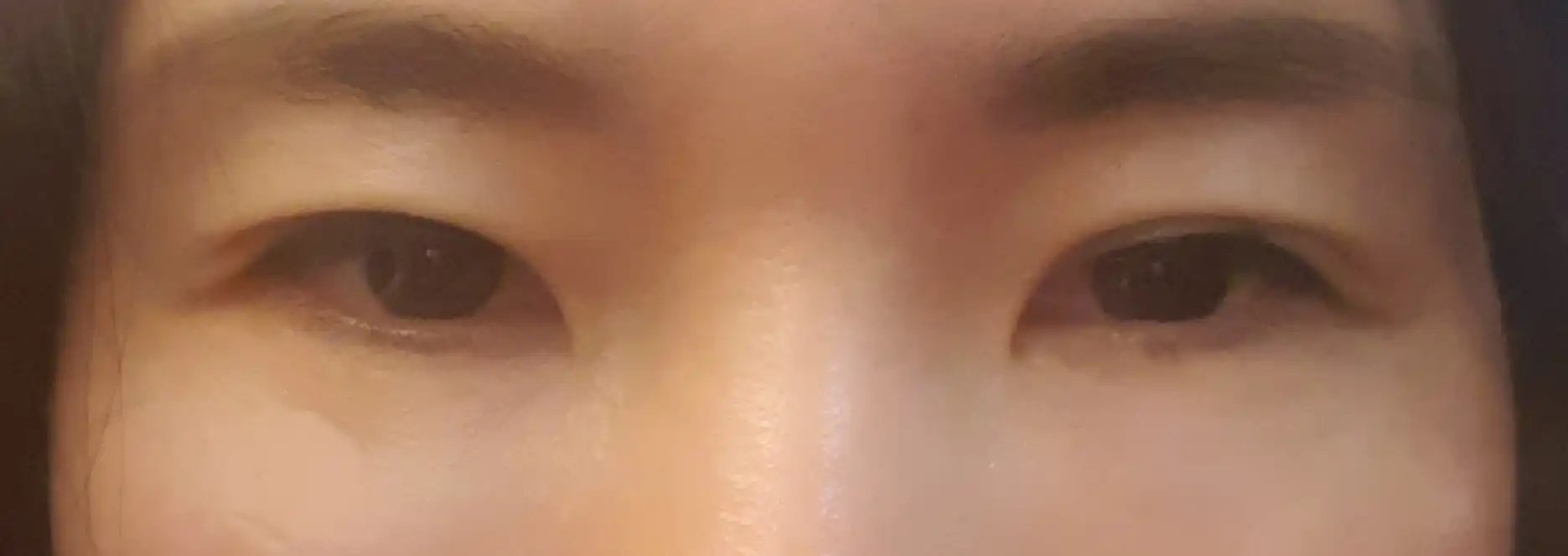 후
