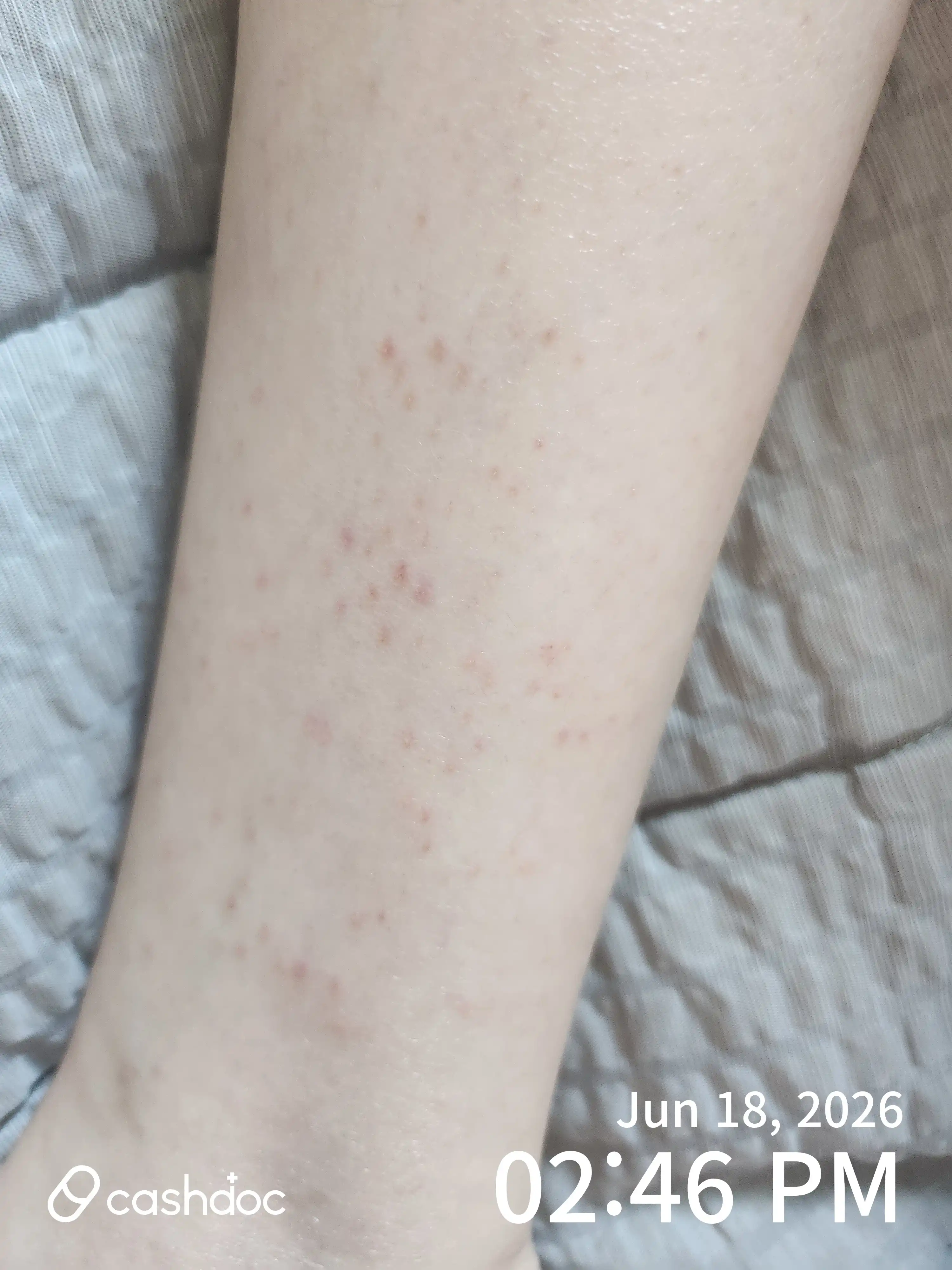评价照片