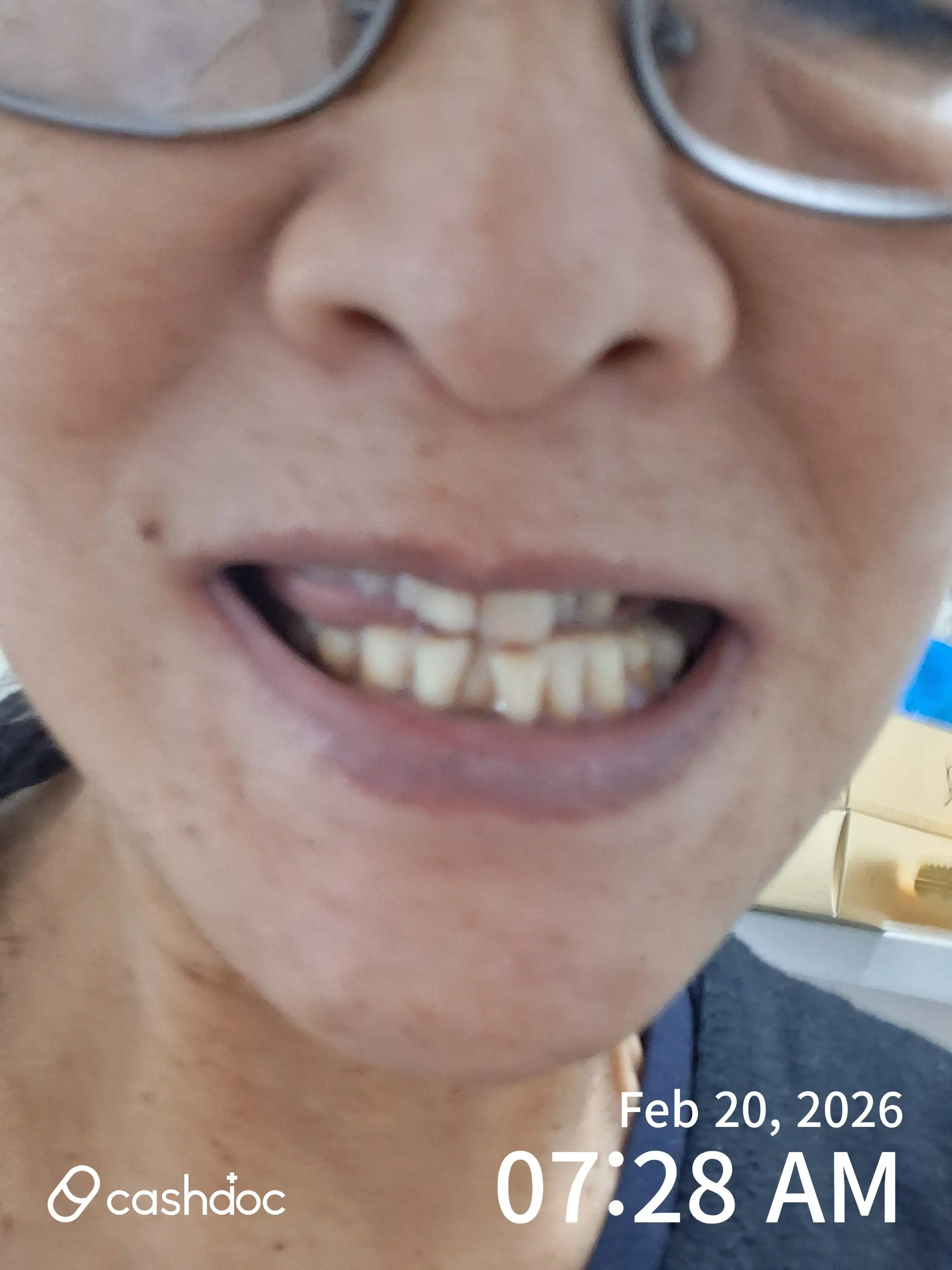 Review photo