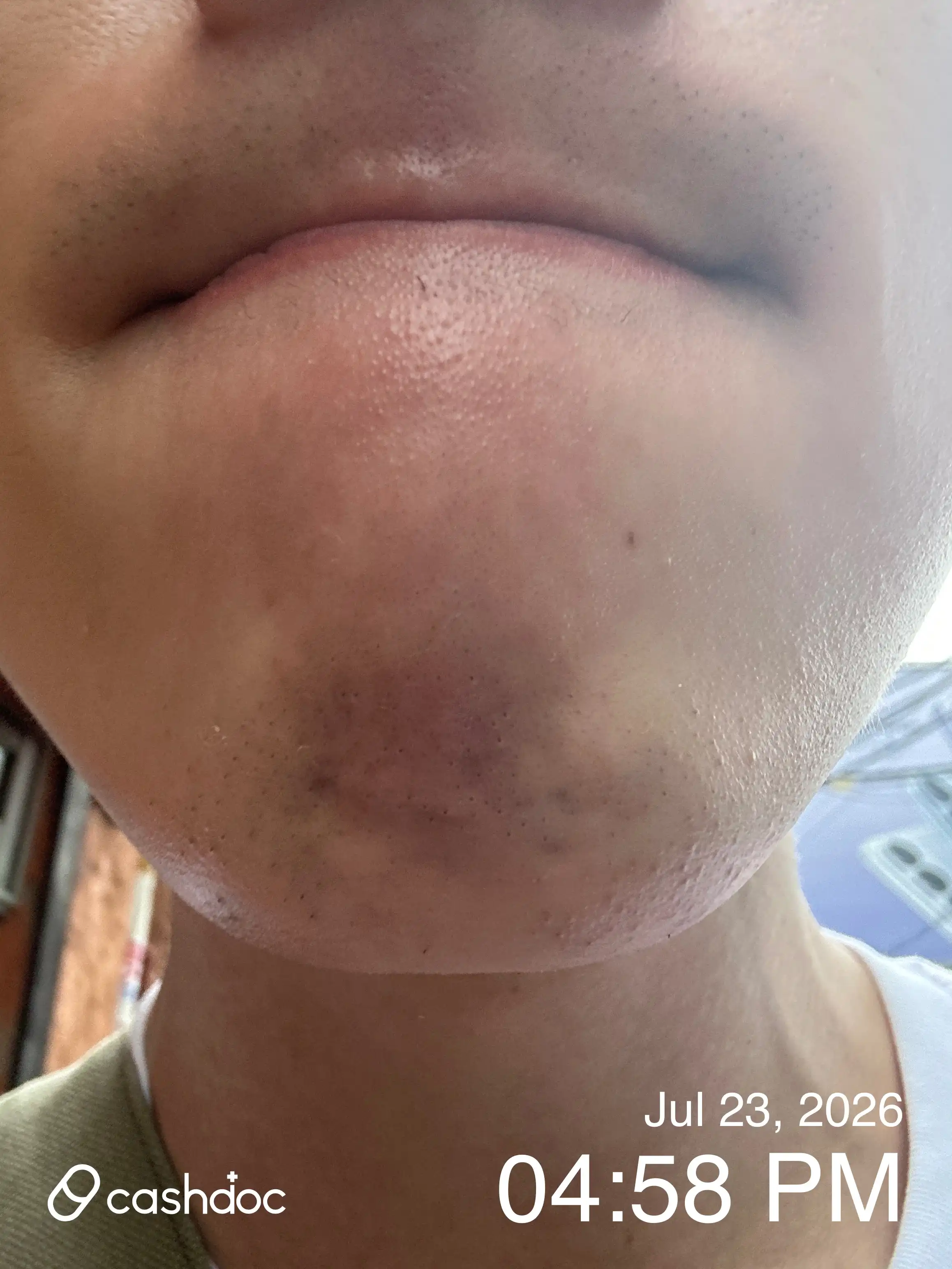 评价照片