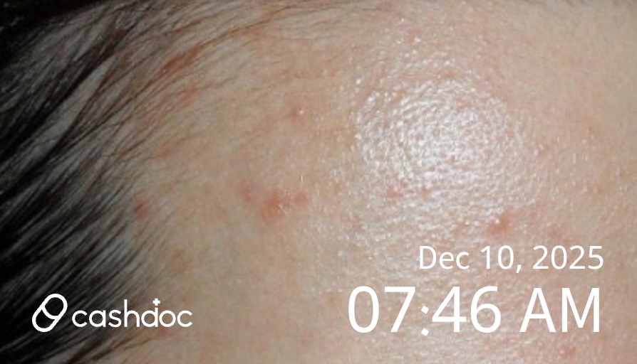 용인청담피부과의원에서 피부 트러블 치료 후 만족스러워요