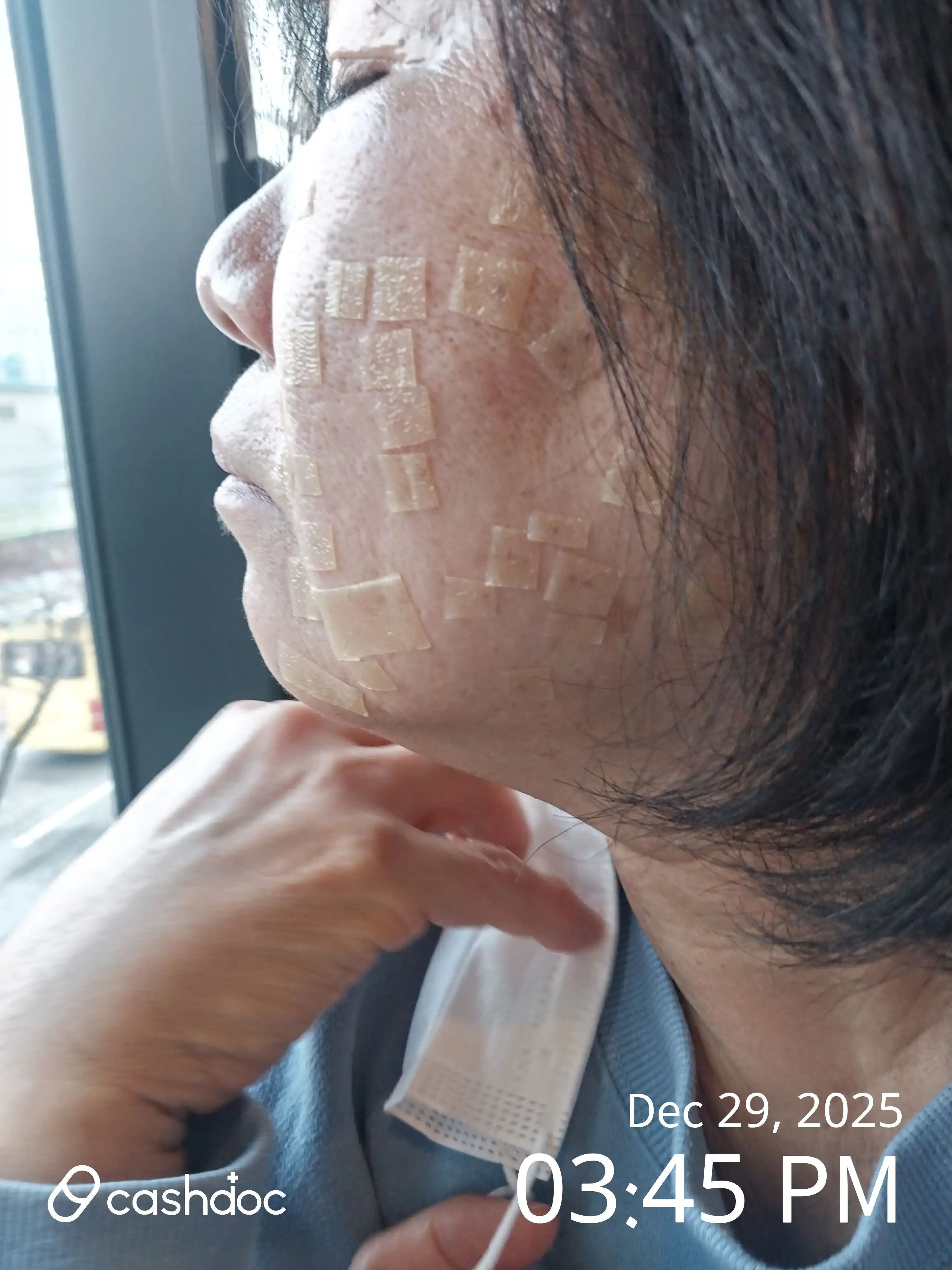 Review photo