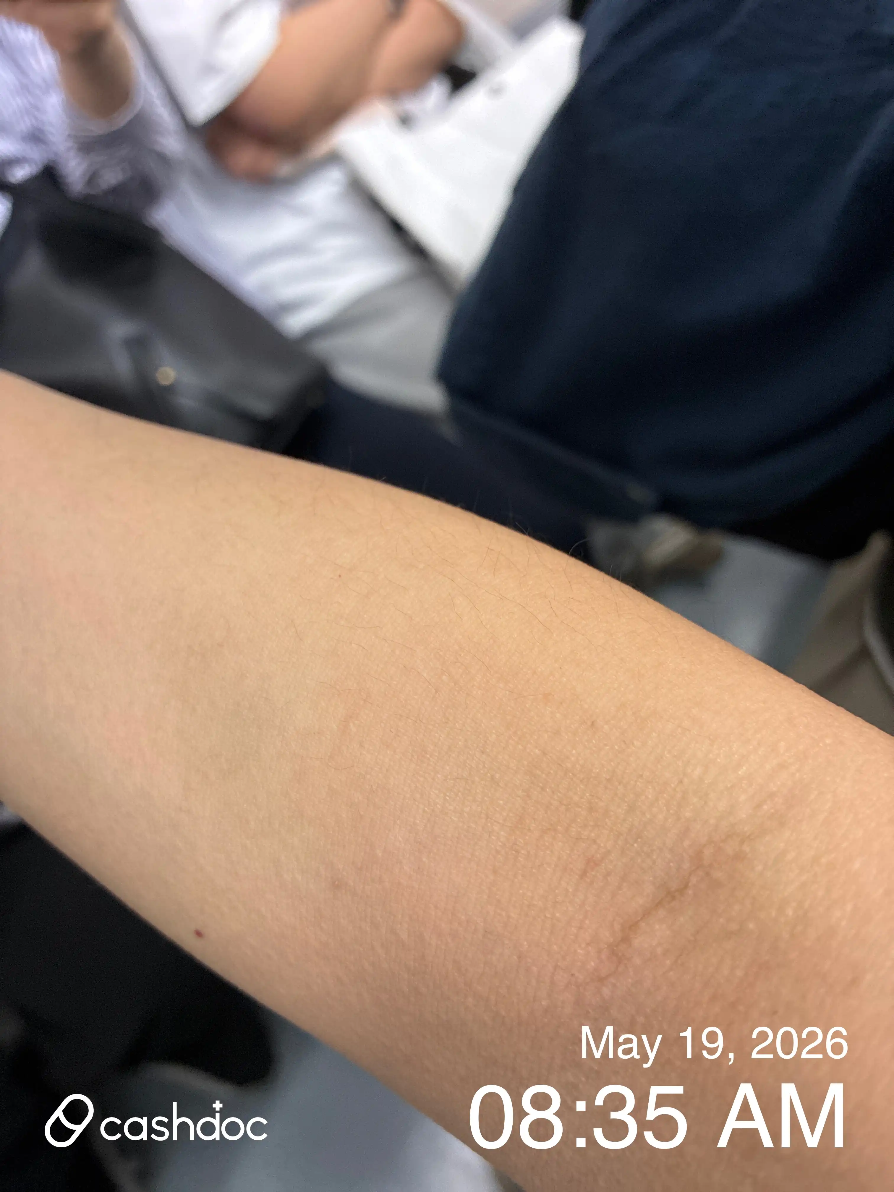 Review photo