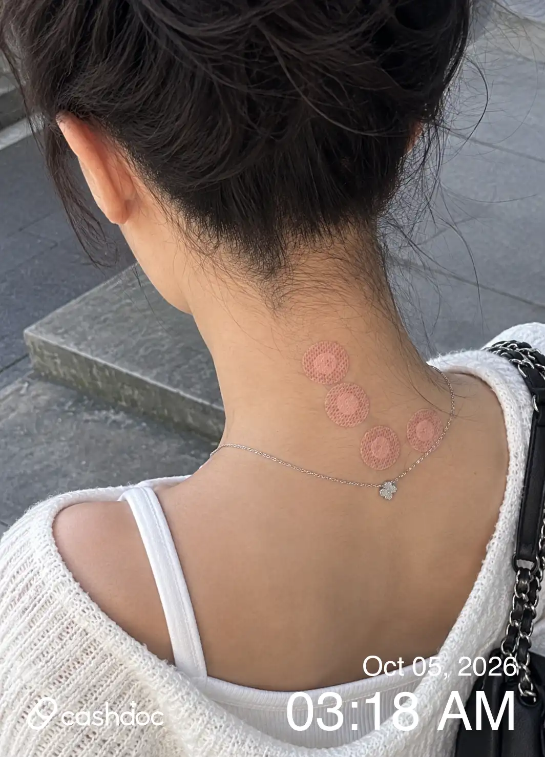 评价照片