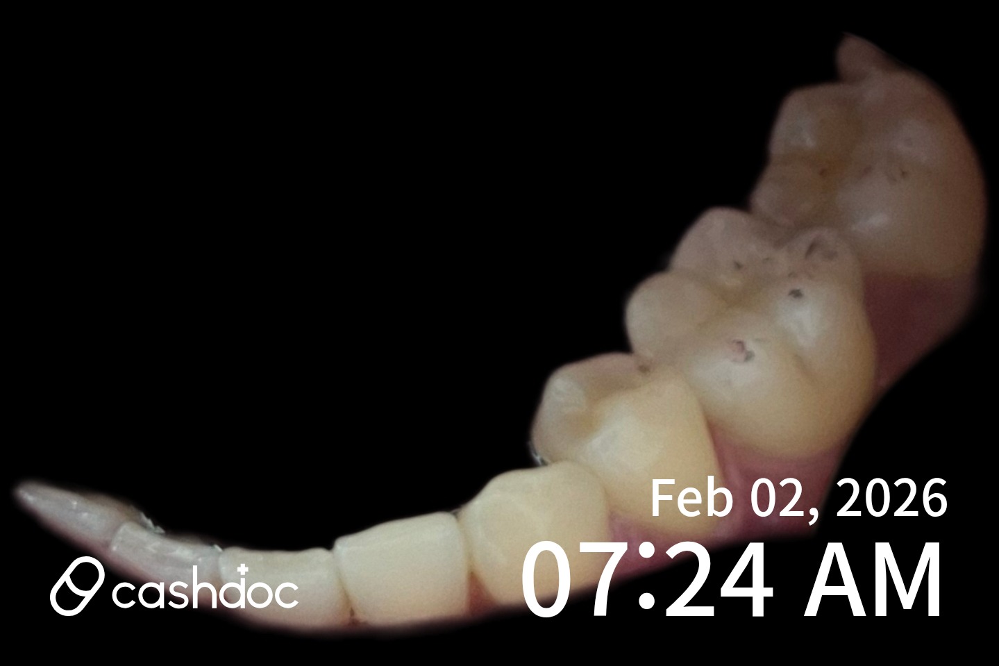 서초구 리엔장성형외과, 비용 부담 적고 치료 만족스러워