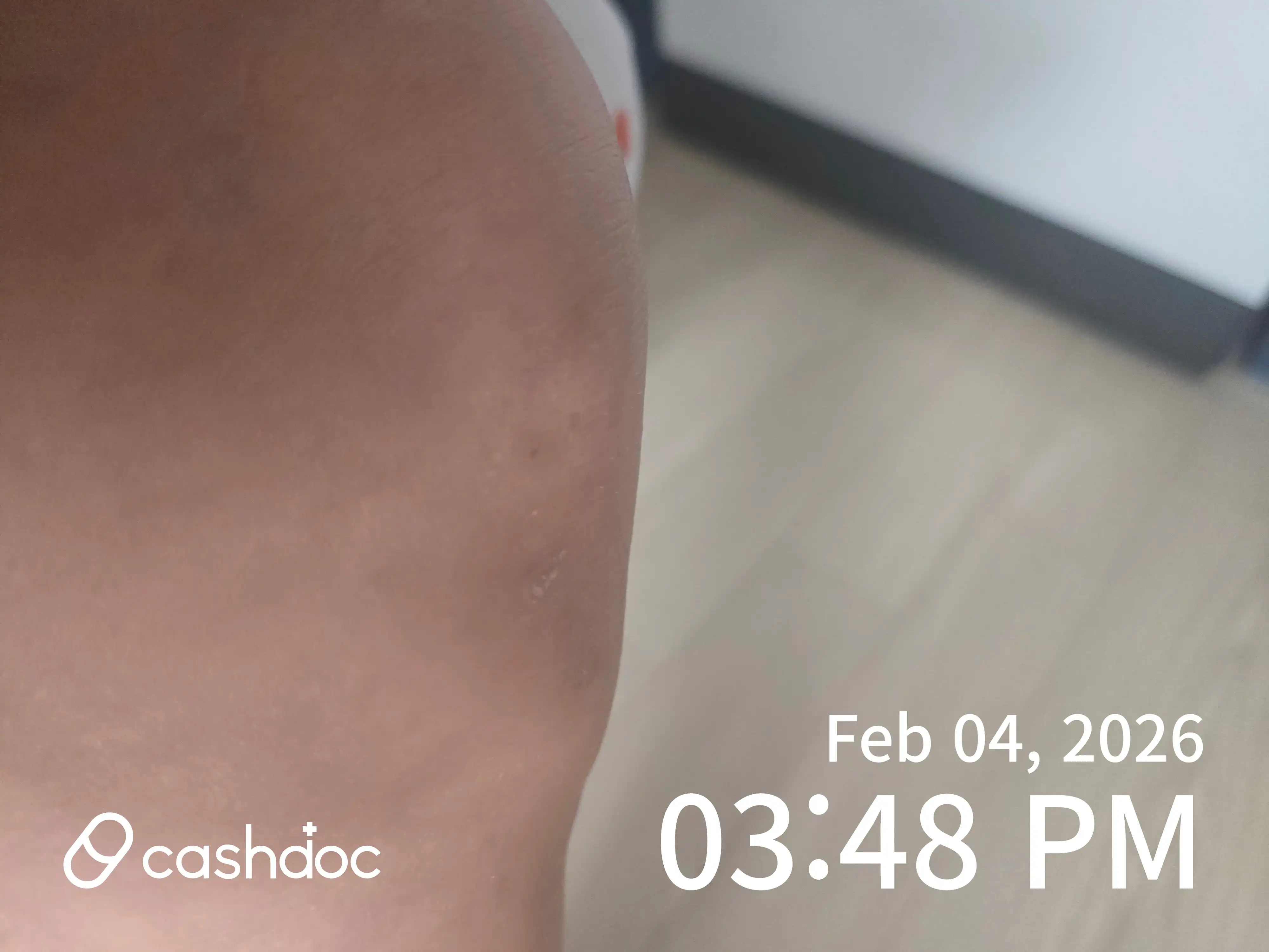 Review photo