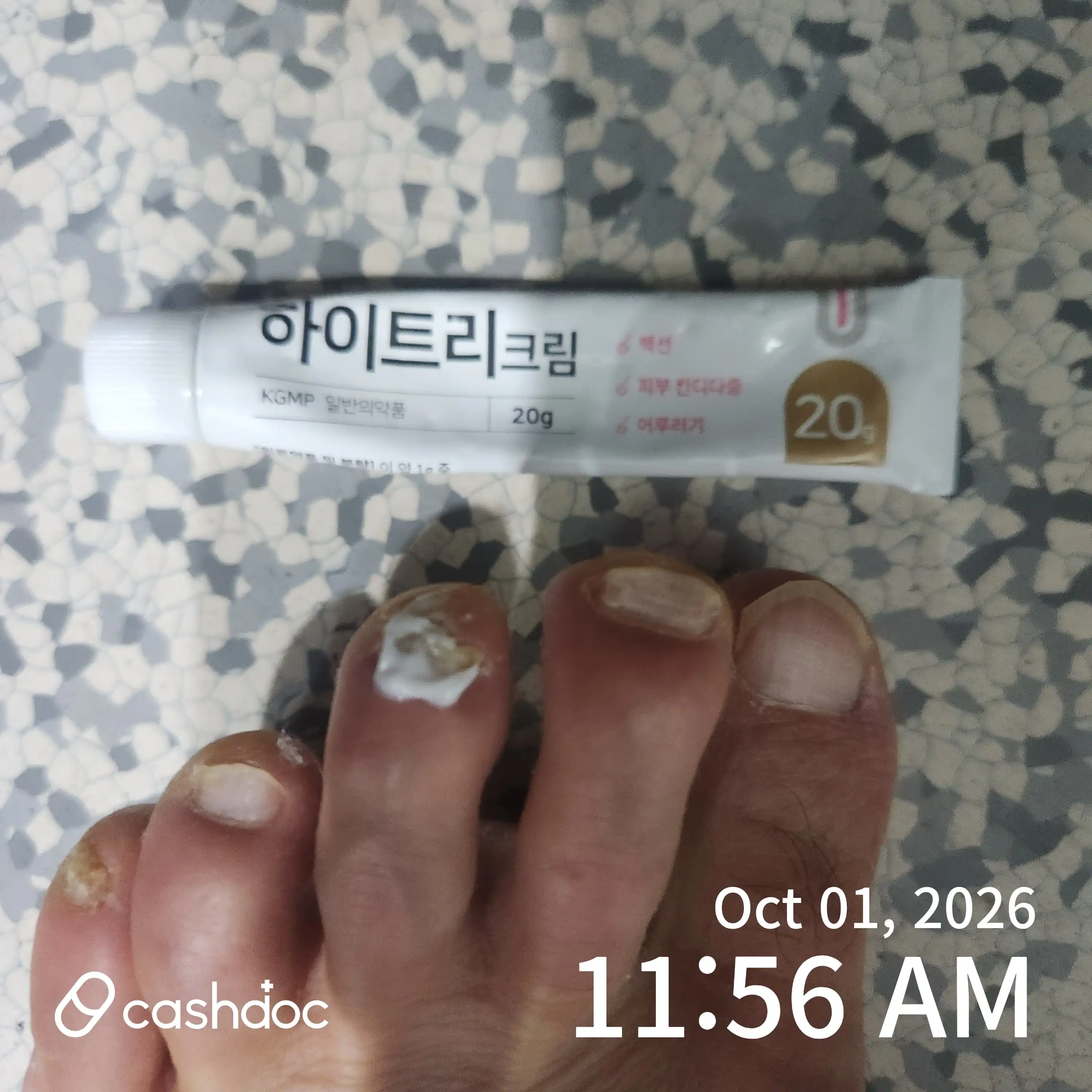 Review photo