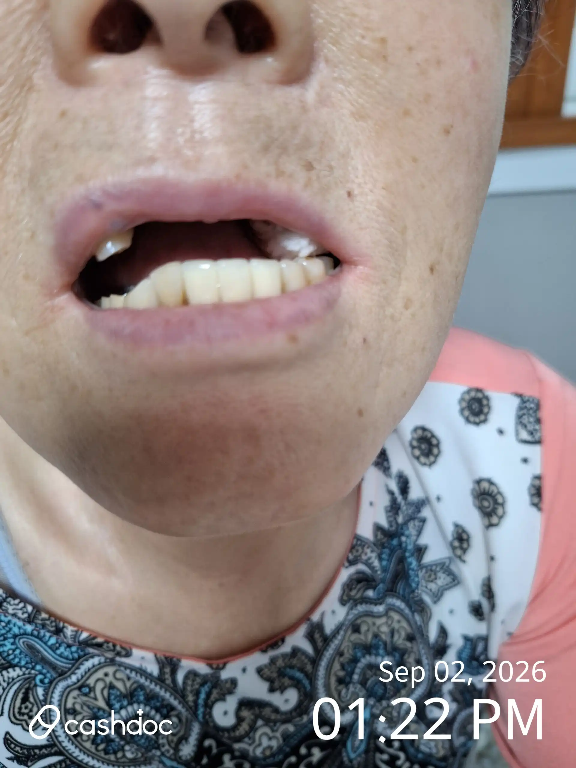 评价照片