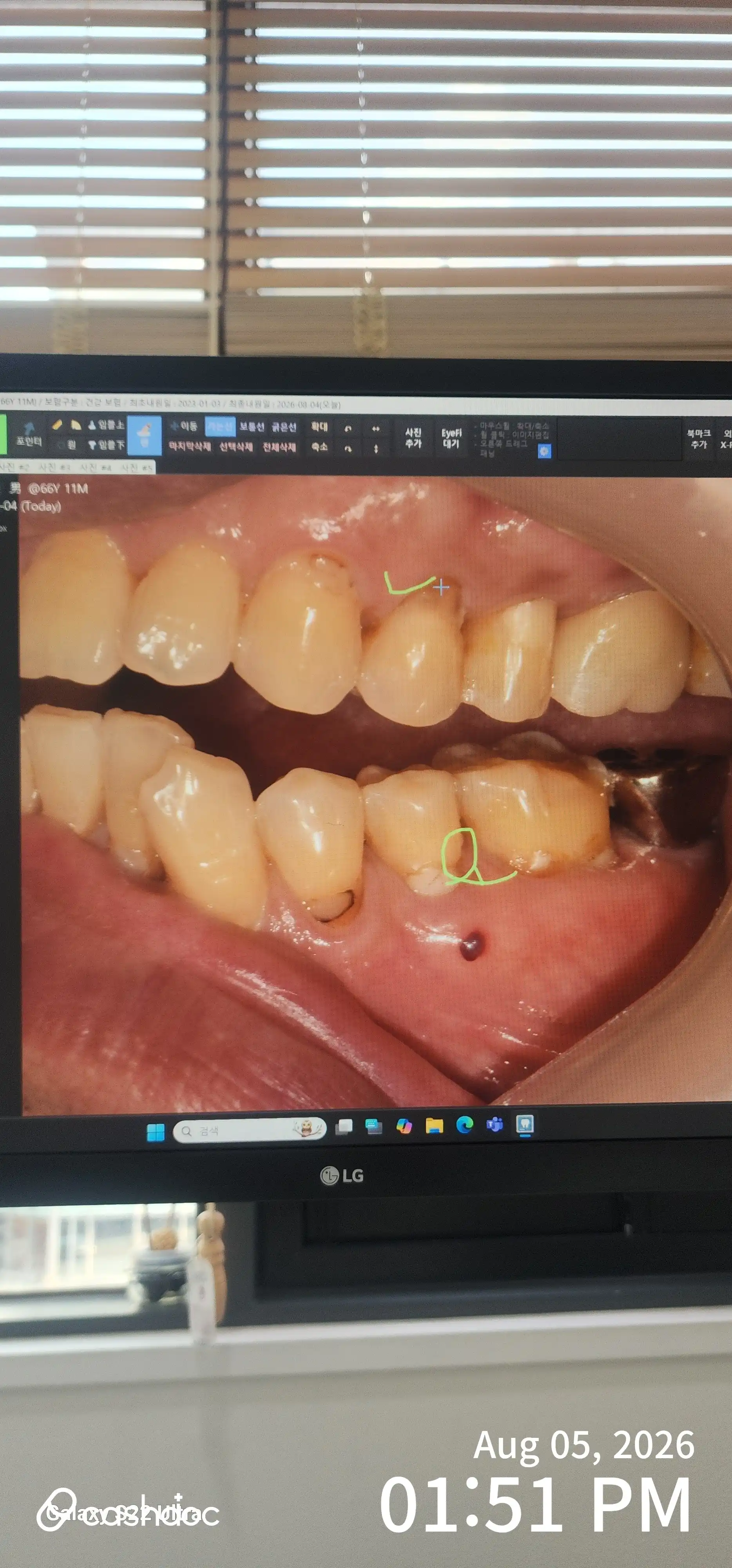 Review photo