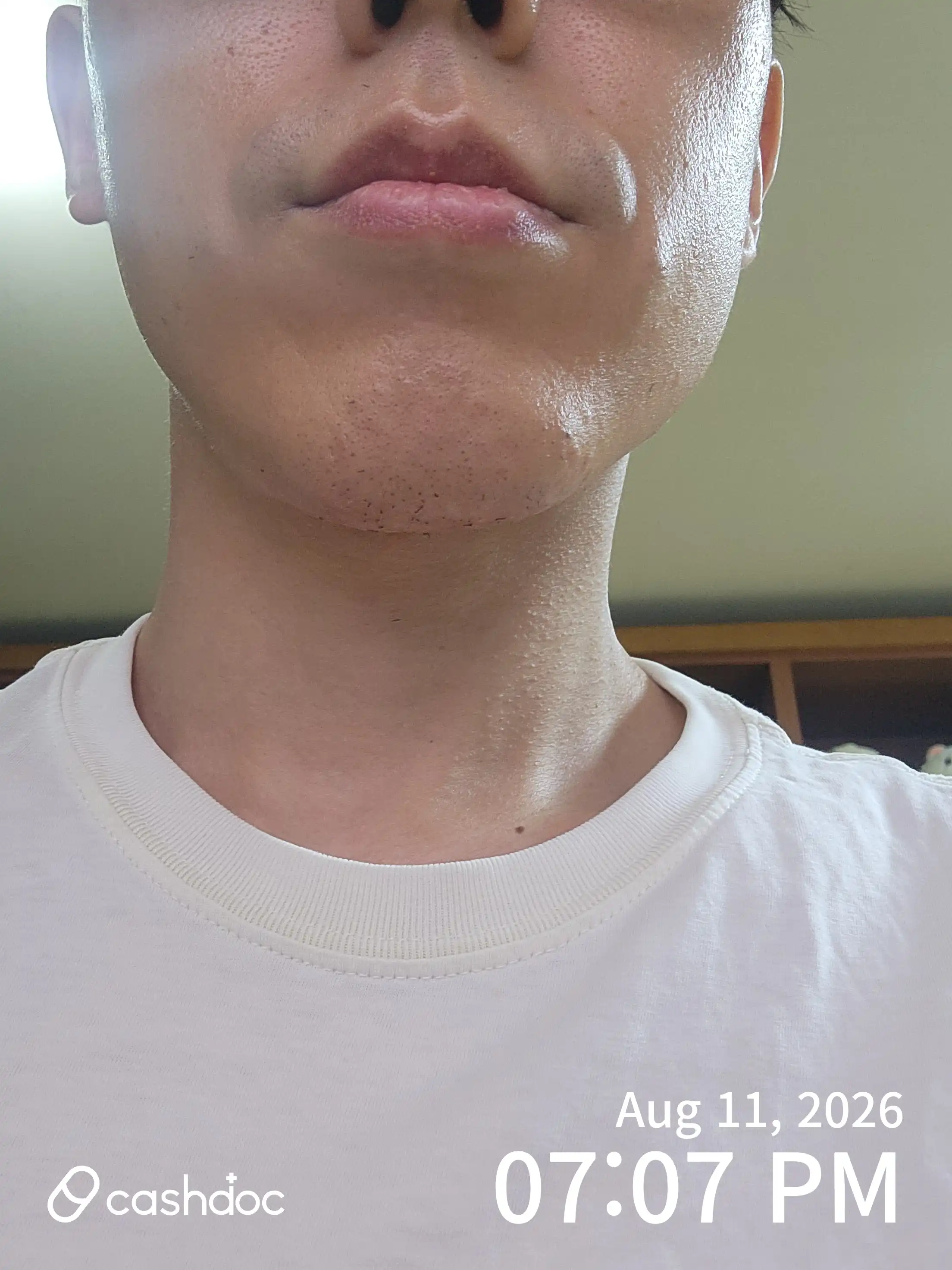 Review photo