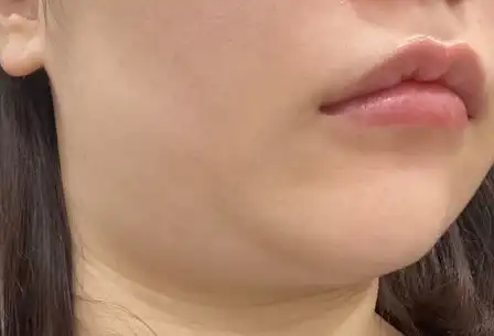 전