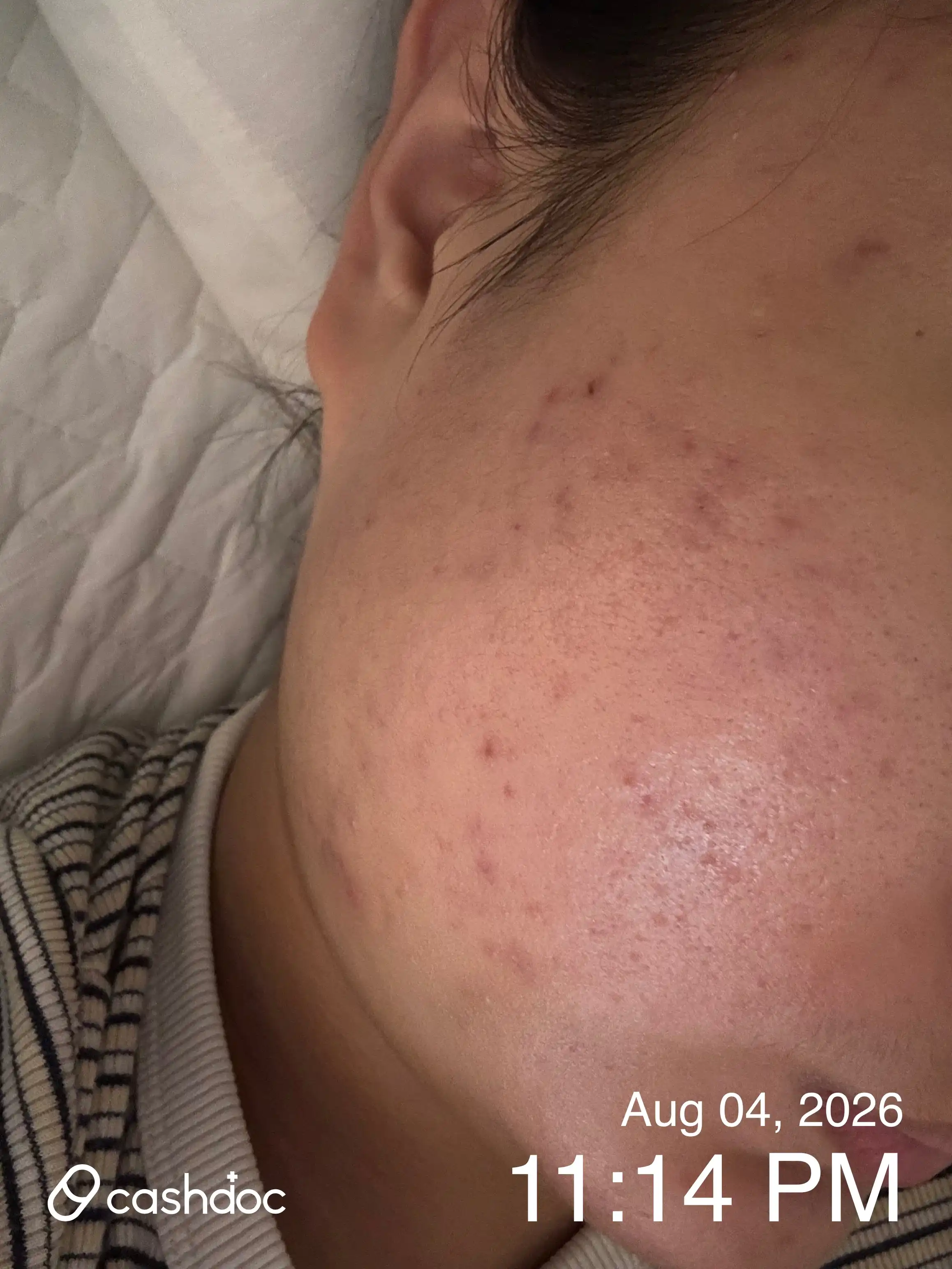 Review photo