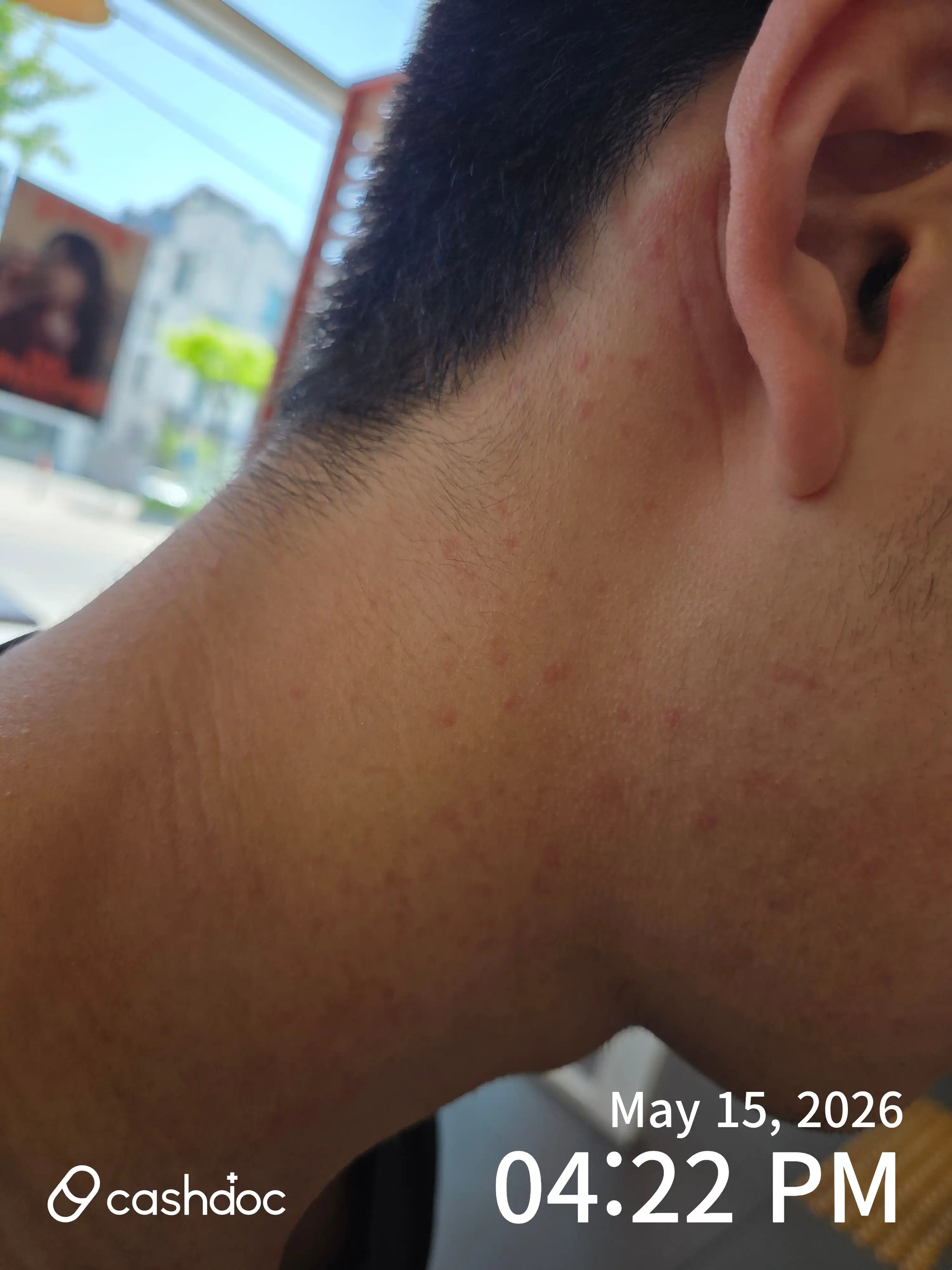 Review photo