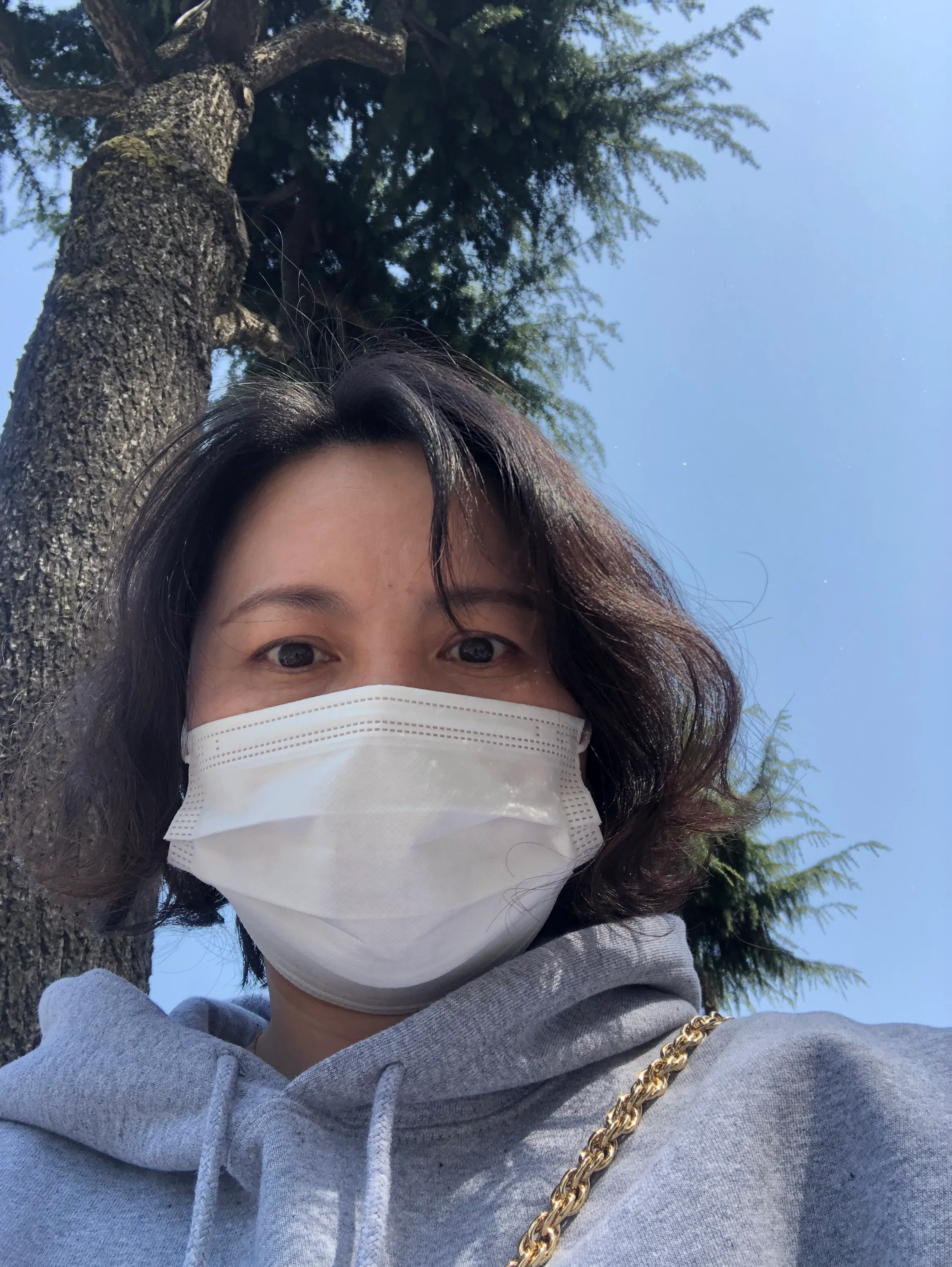시술 전 — 초간편 반영구 패키지