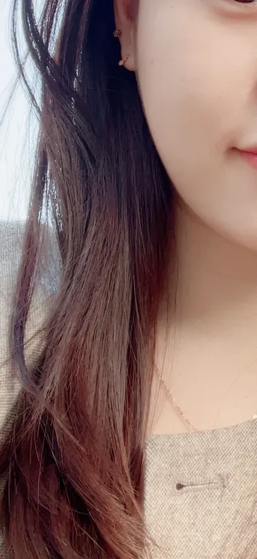 시술 후 — 색소 치료와 예방을 동시에 듀얼토닝