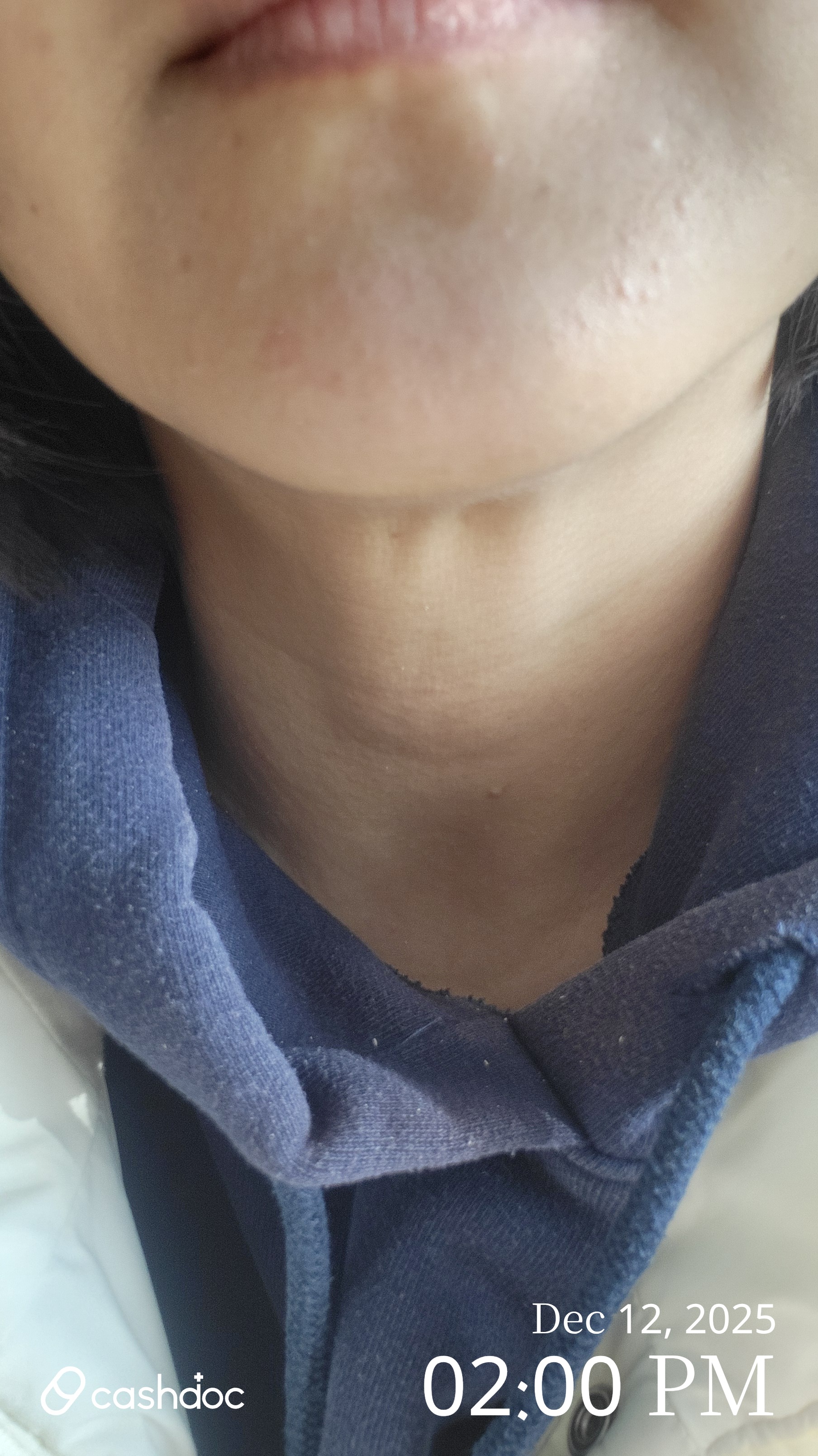 전주시 수경피부과에서 로션 처방 받고 후다닥 나왔어요