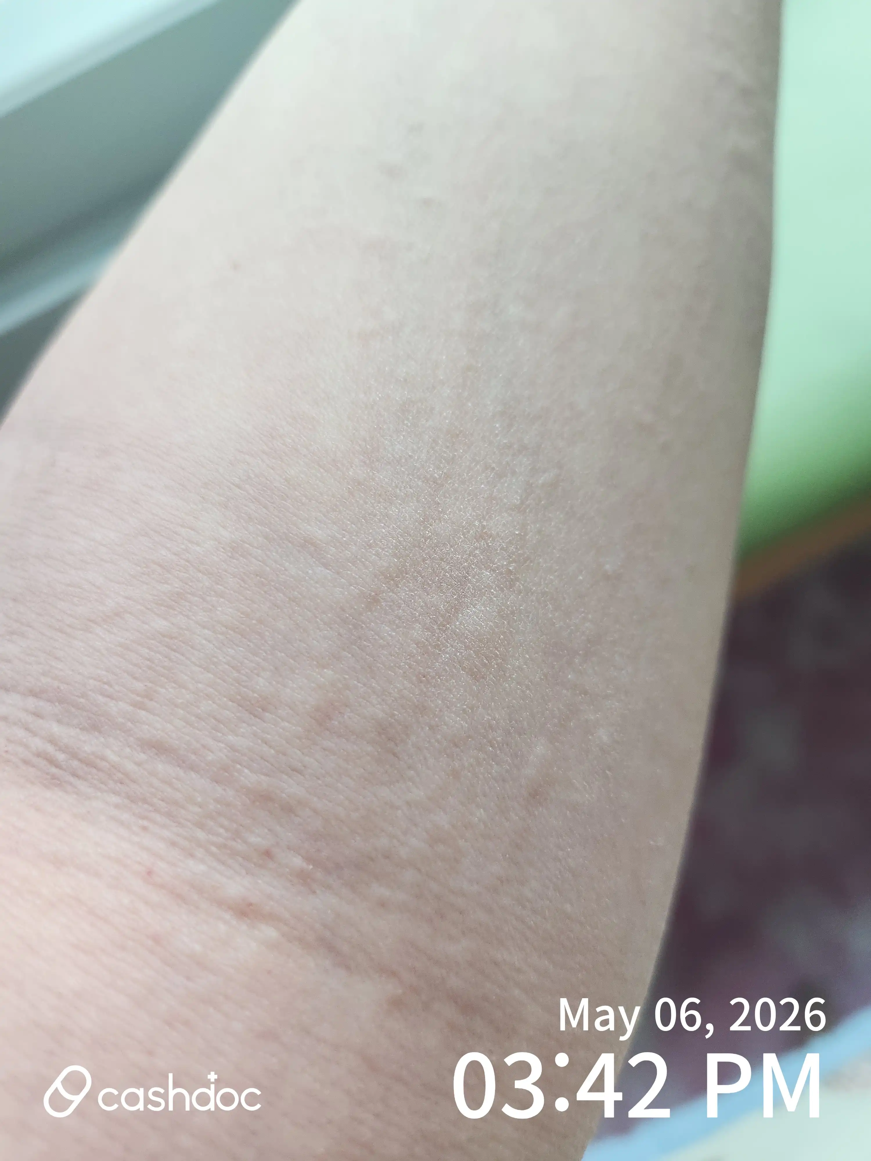 Review photo