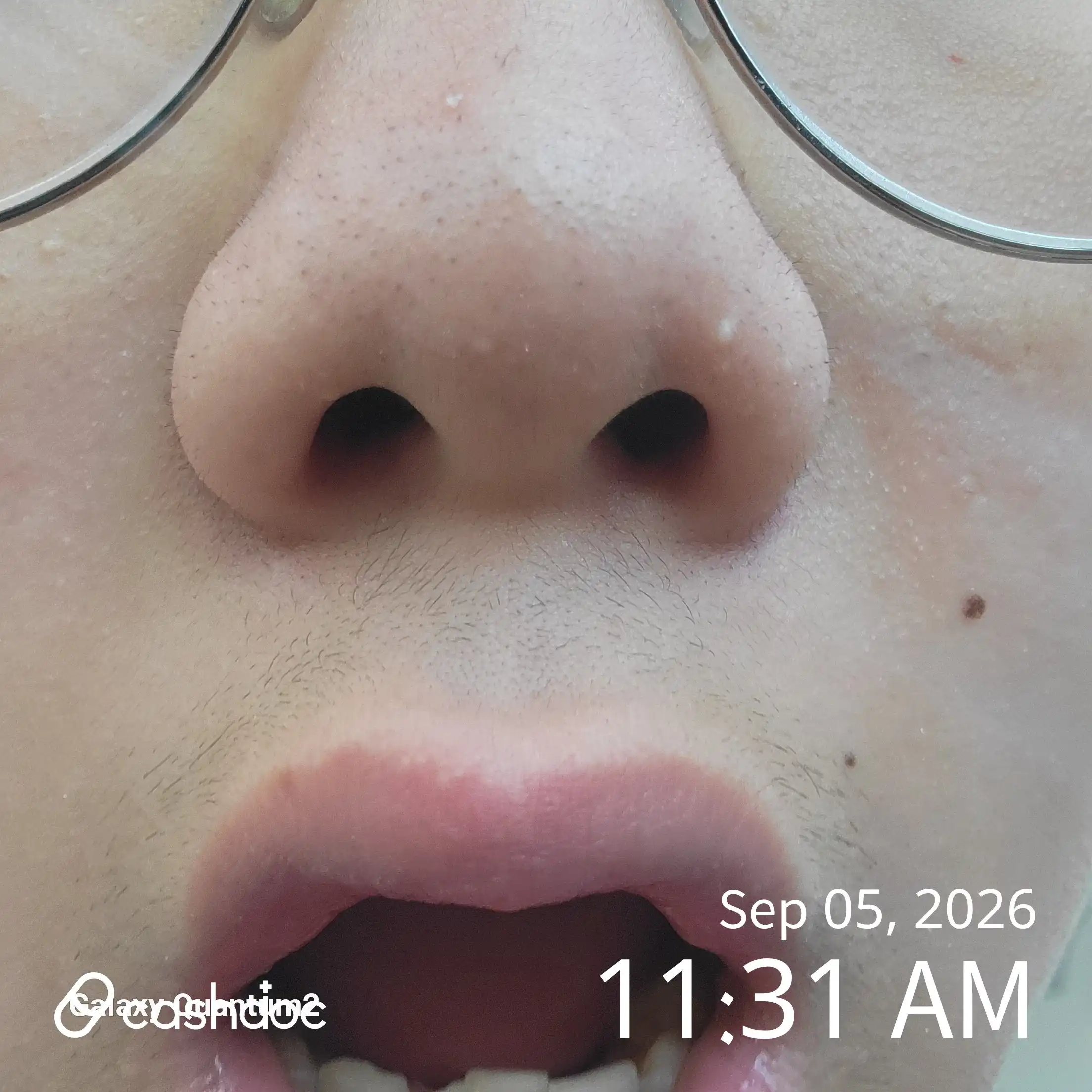 Review photo