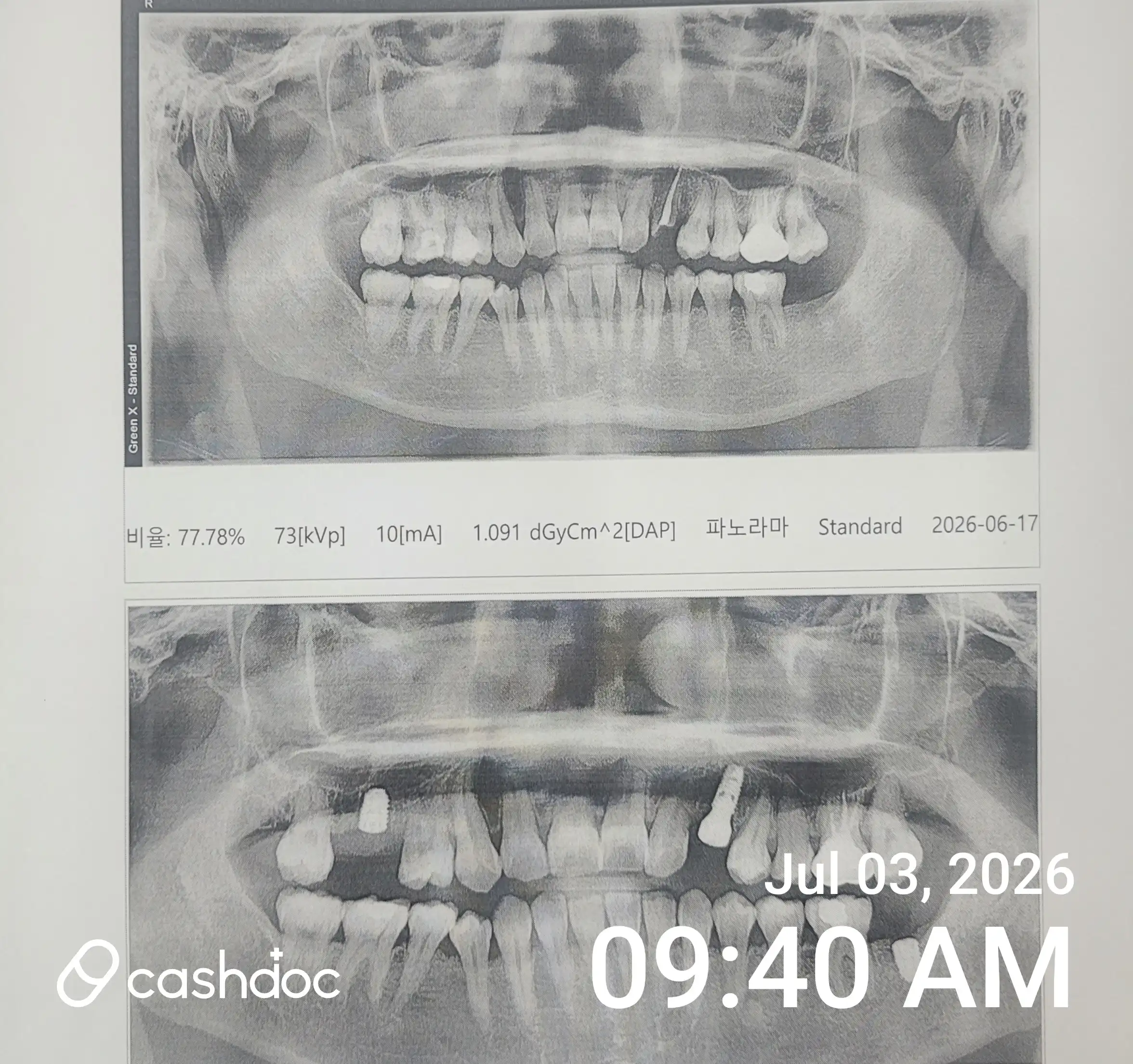 Review photo