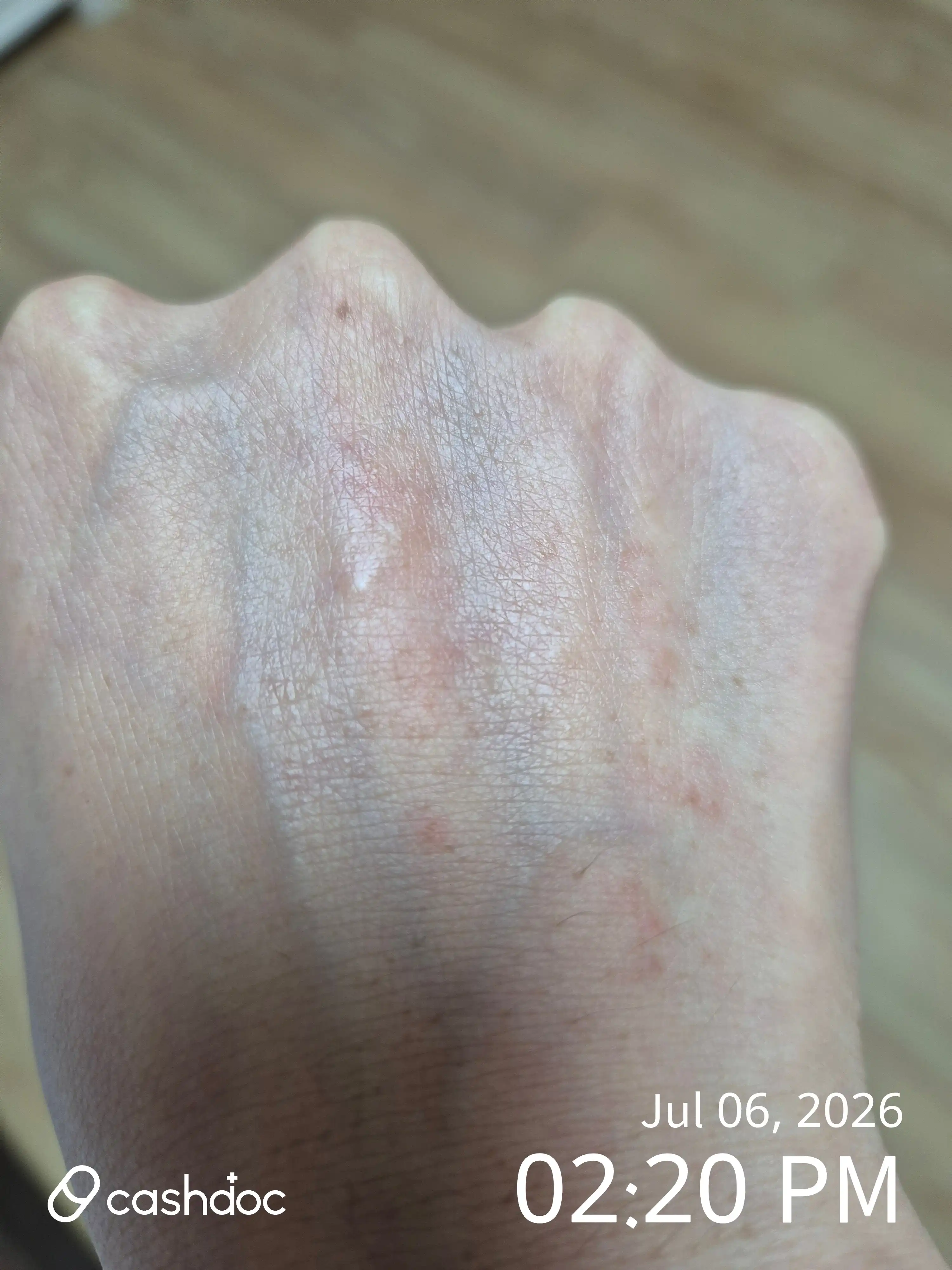 Review photo
