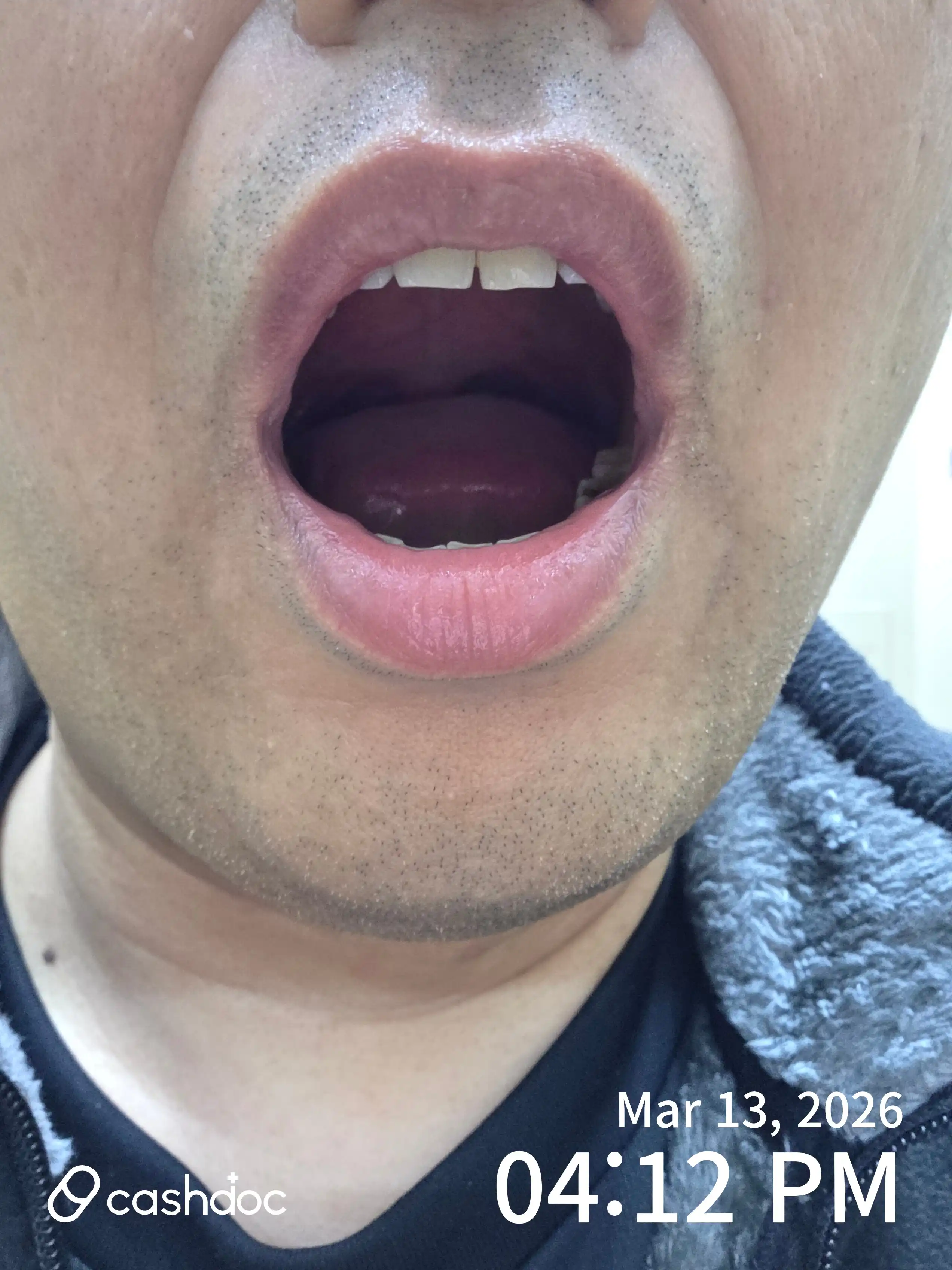 리뷰 사진 1