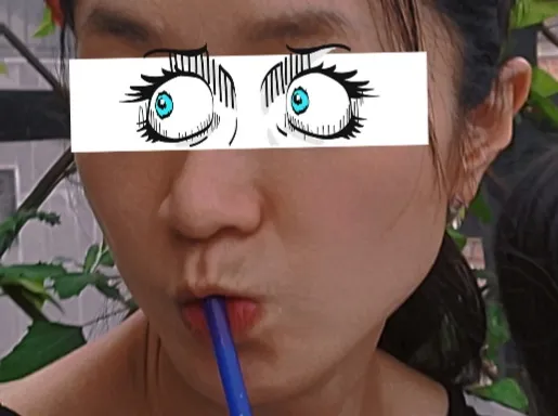 시술 전 — 미케이 민트실 동안 리프팅_팔자,눈가