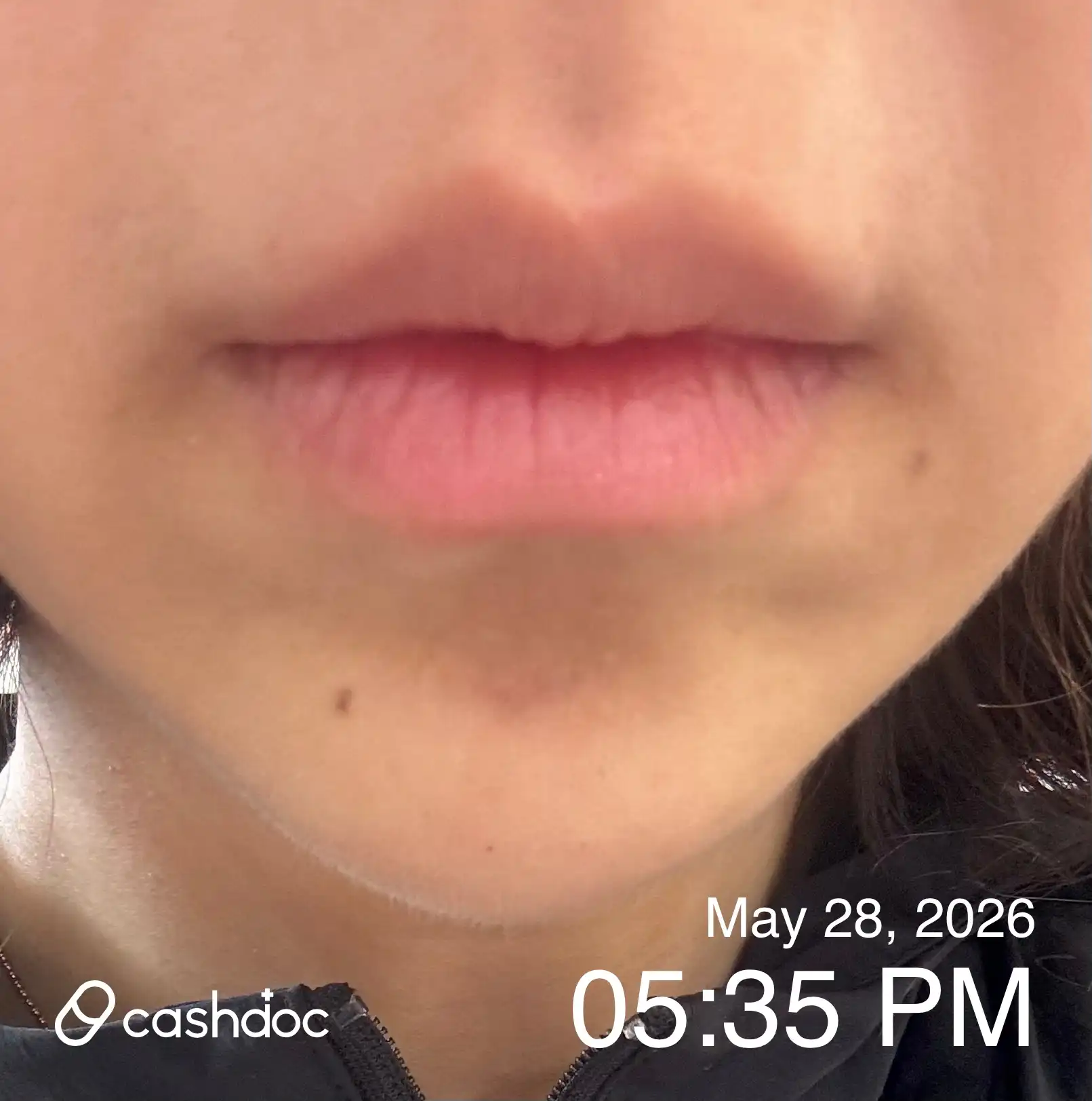 Review photo