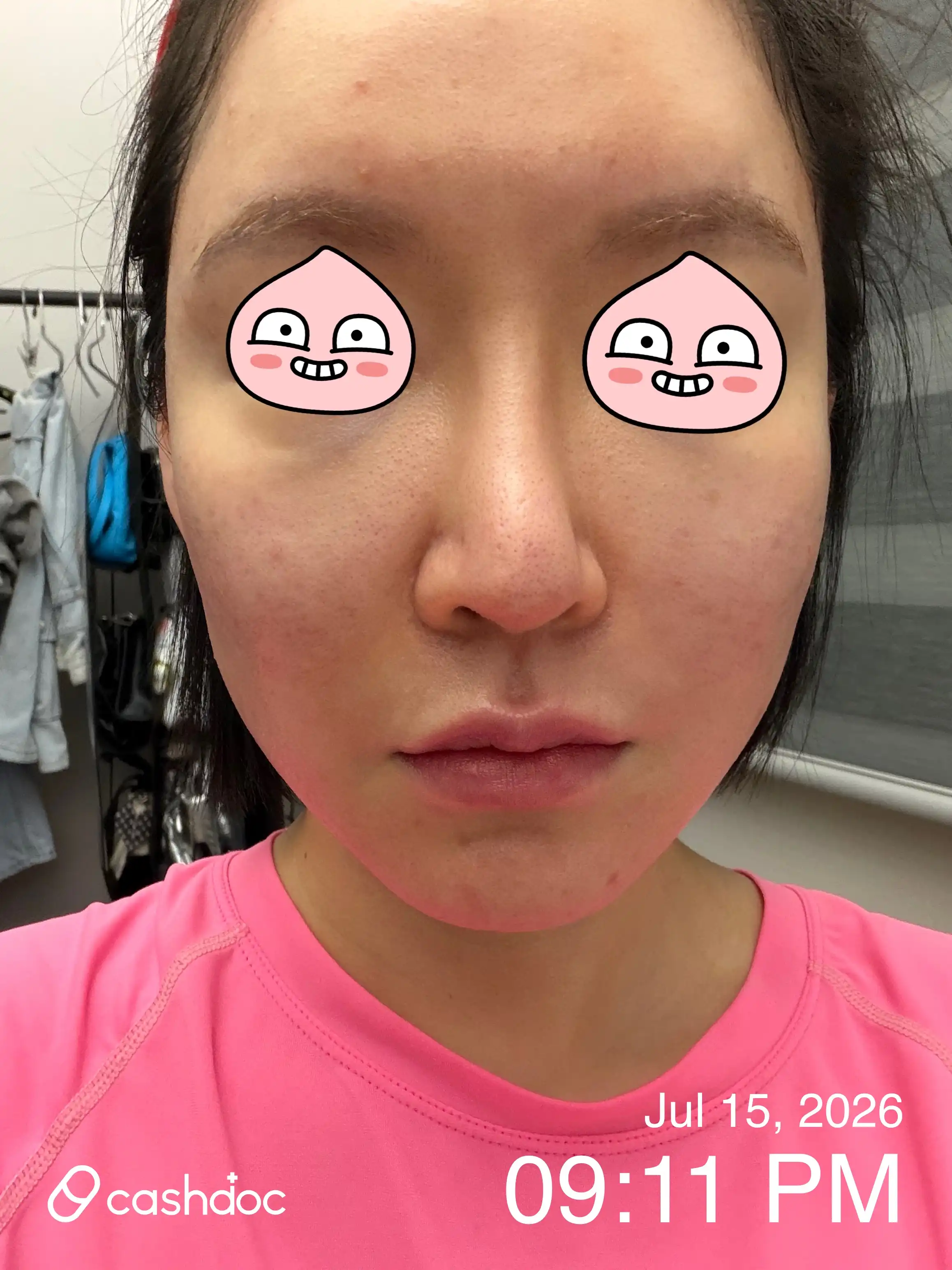 评价照片