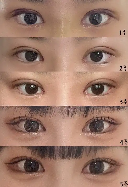 후