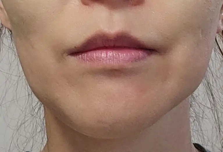전