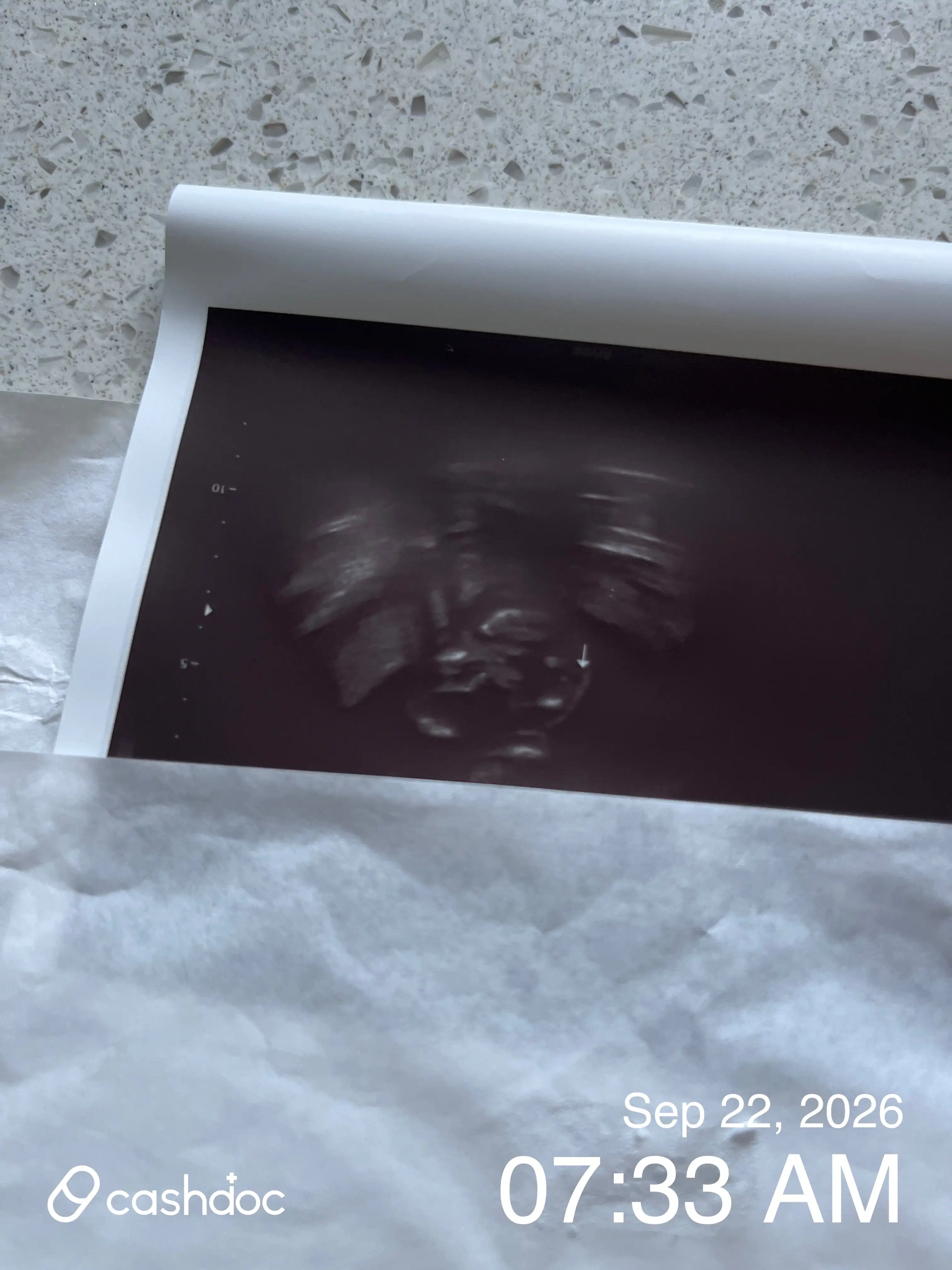 Review photo