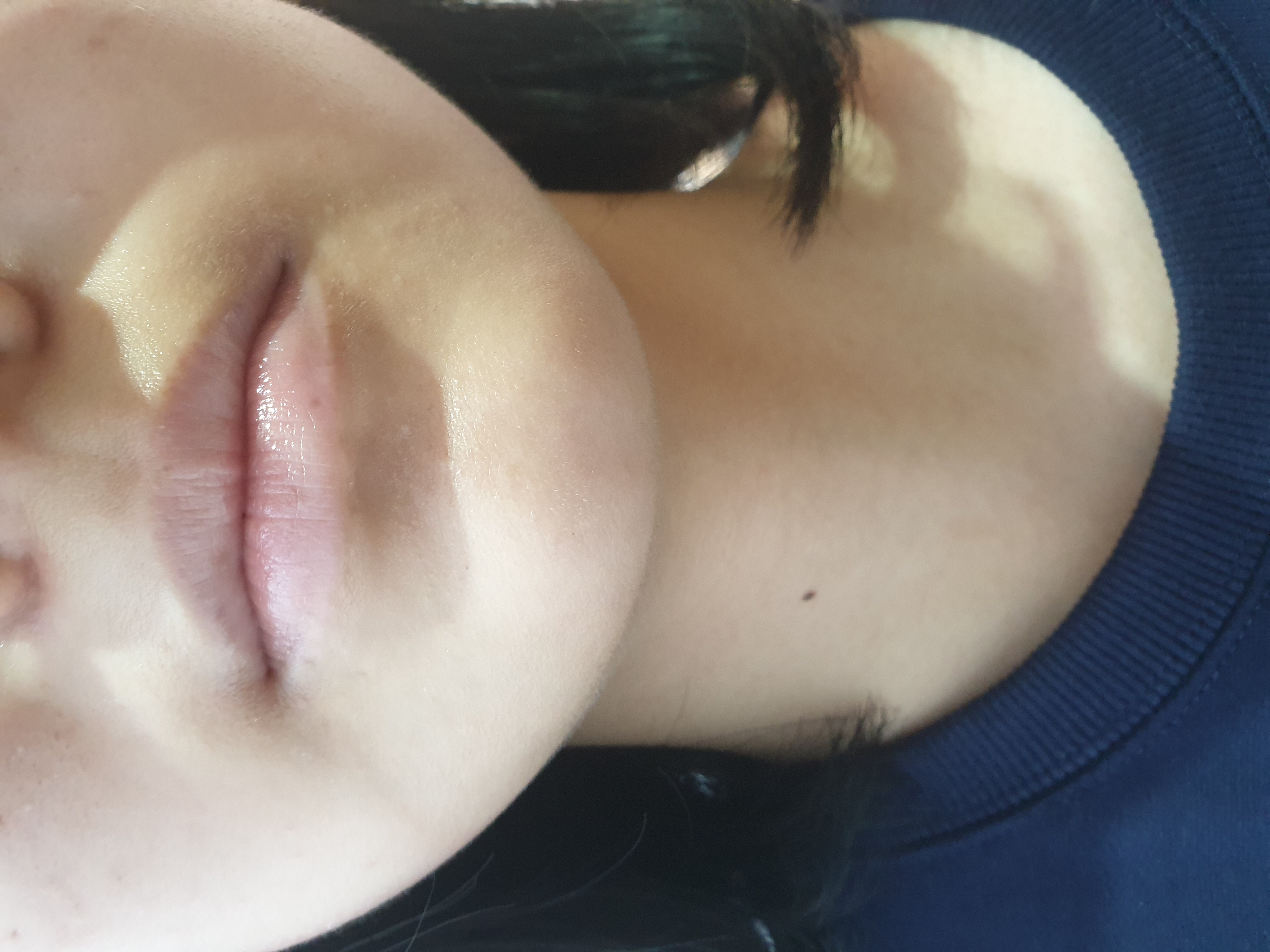 Before