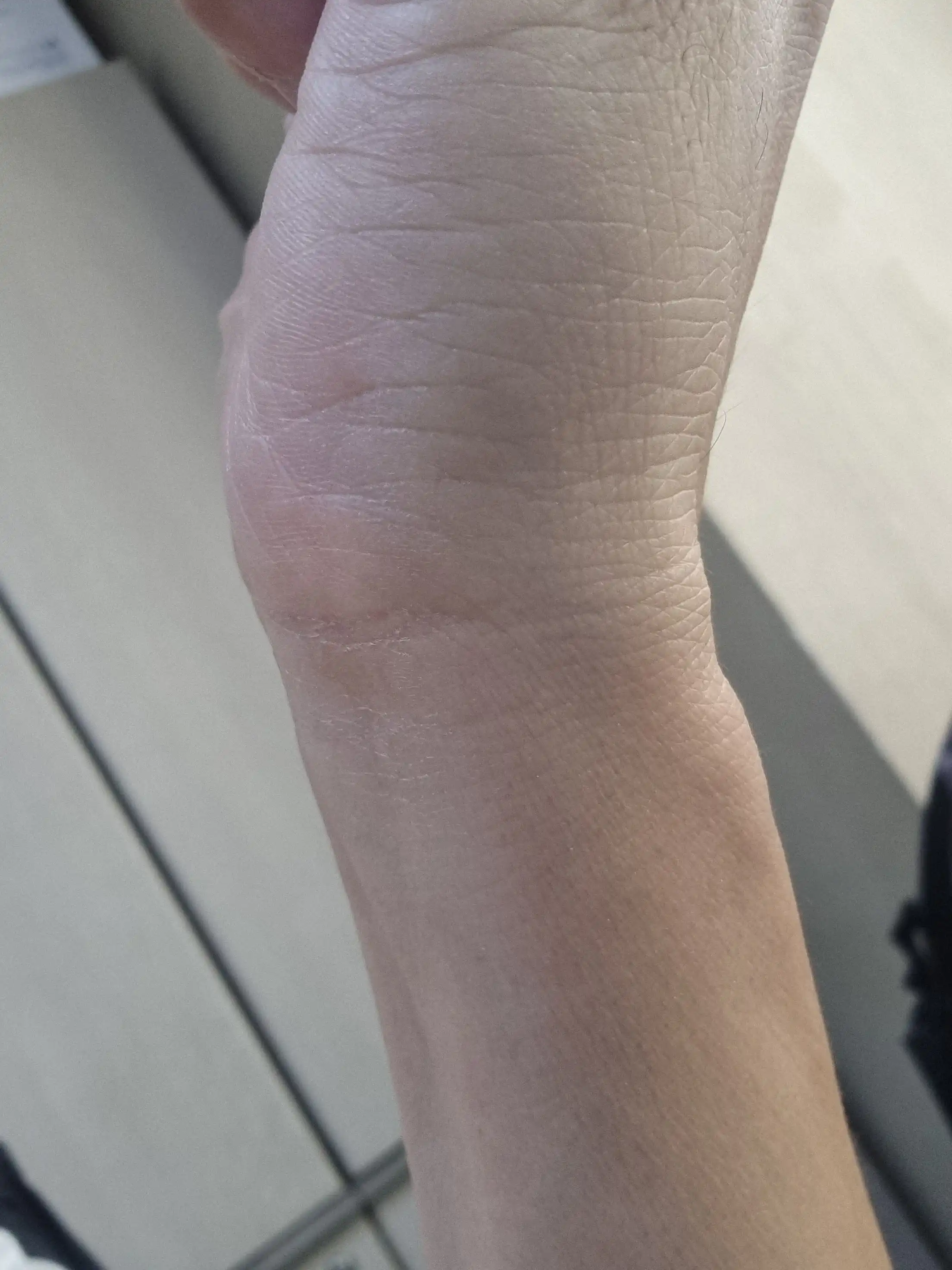 评价照片