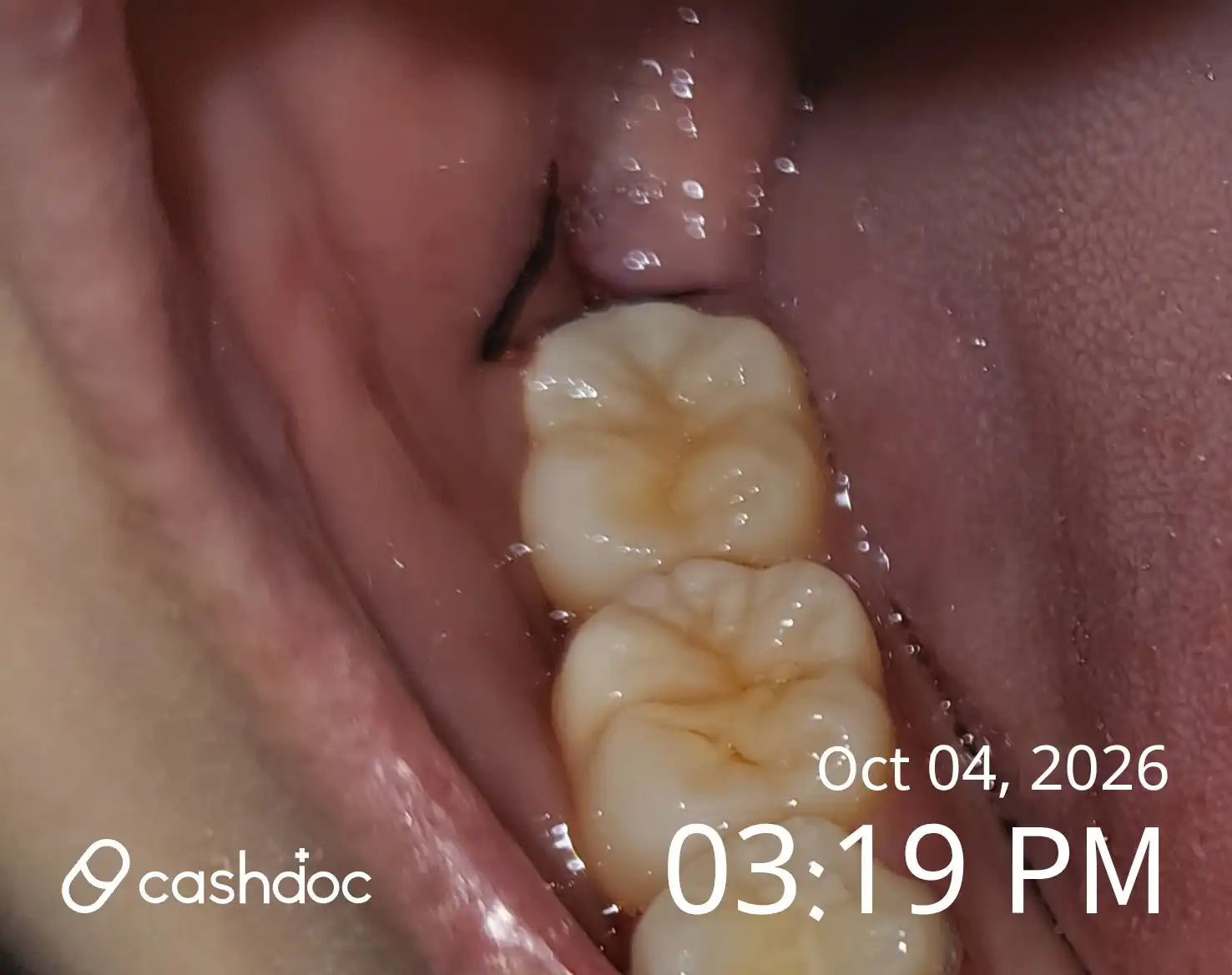 Review photo