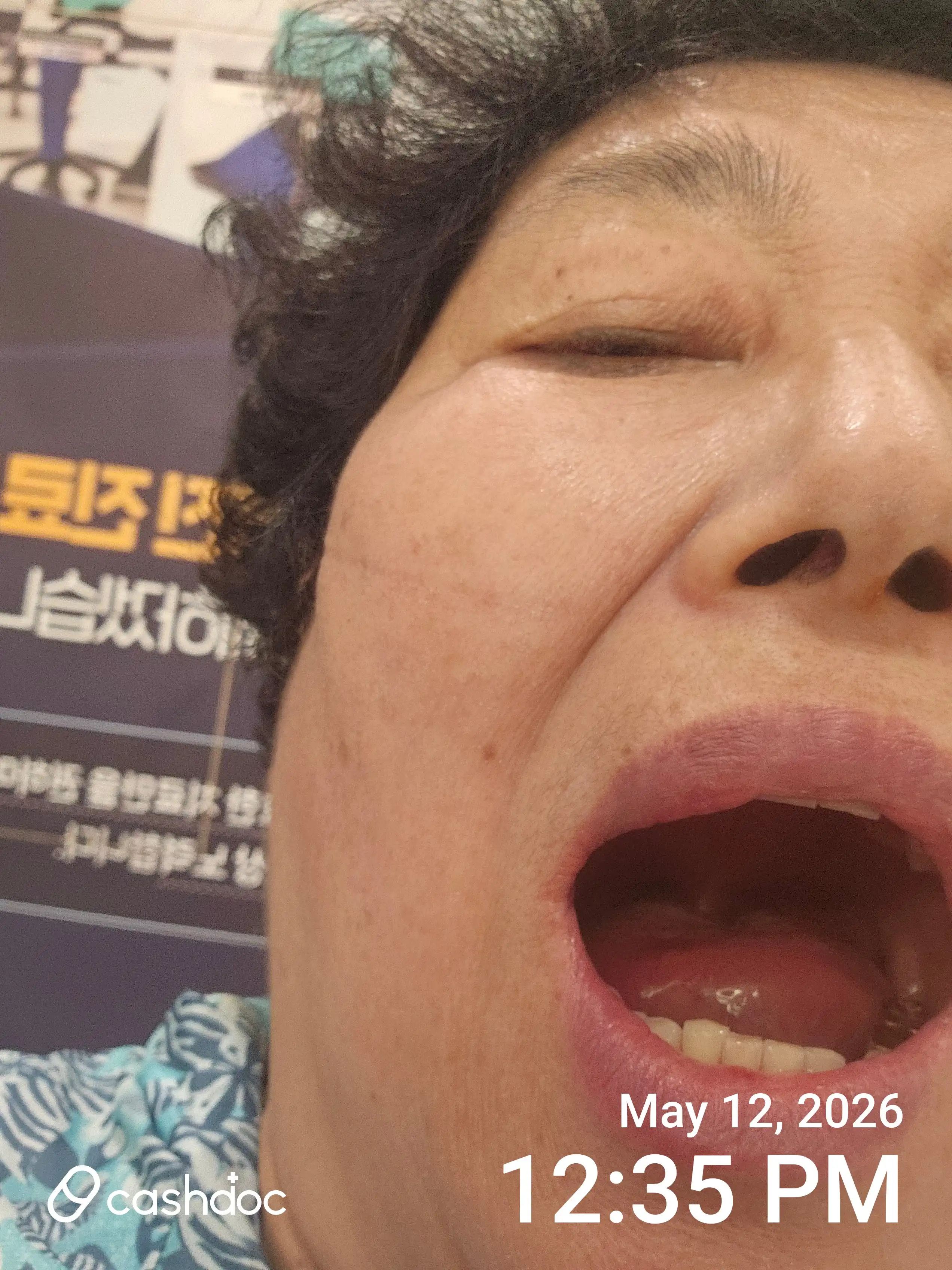 レビュー写真