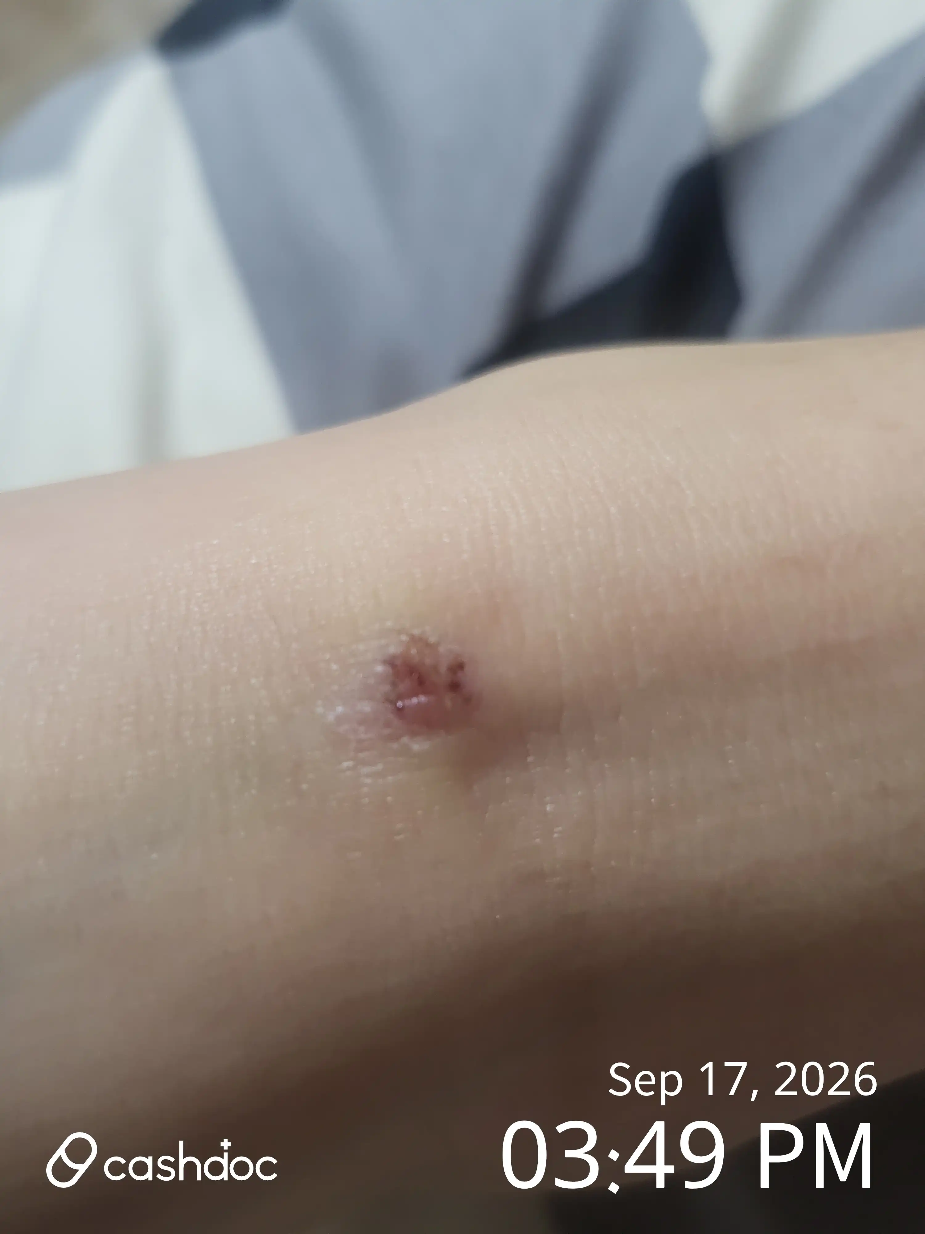 Review photo