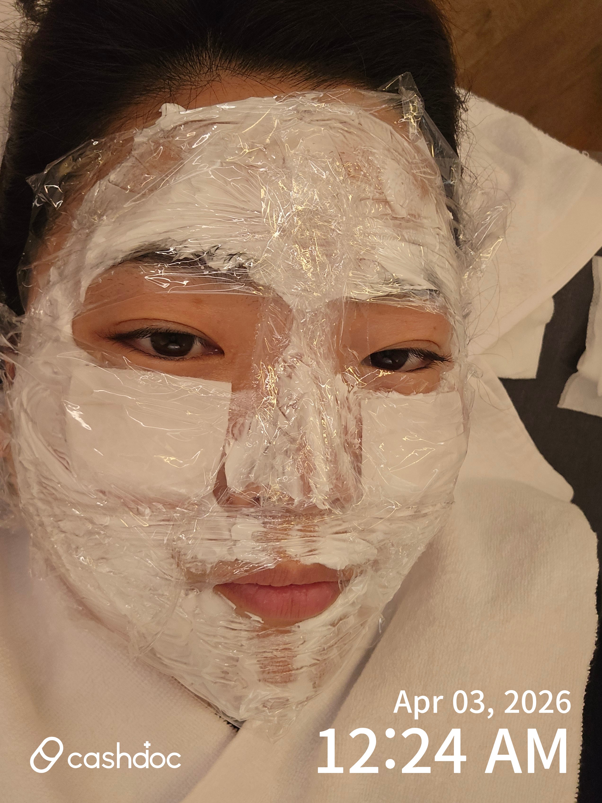 안산시 비올의원, 피부 잡티 완화 메디룩스 시술 후기