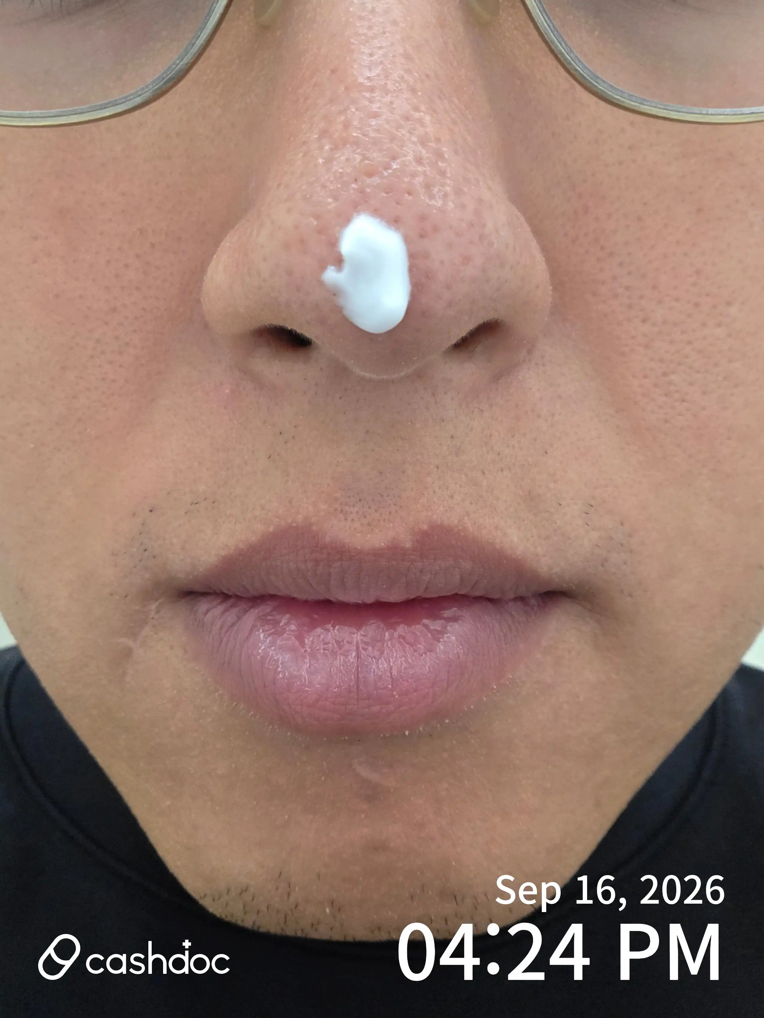 评价照片